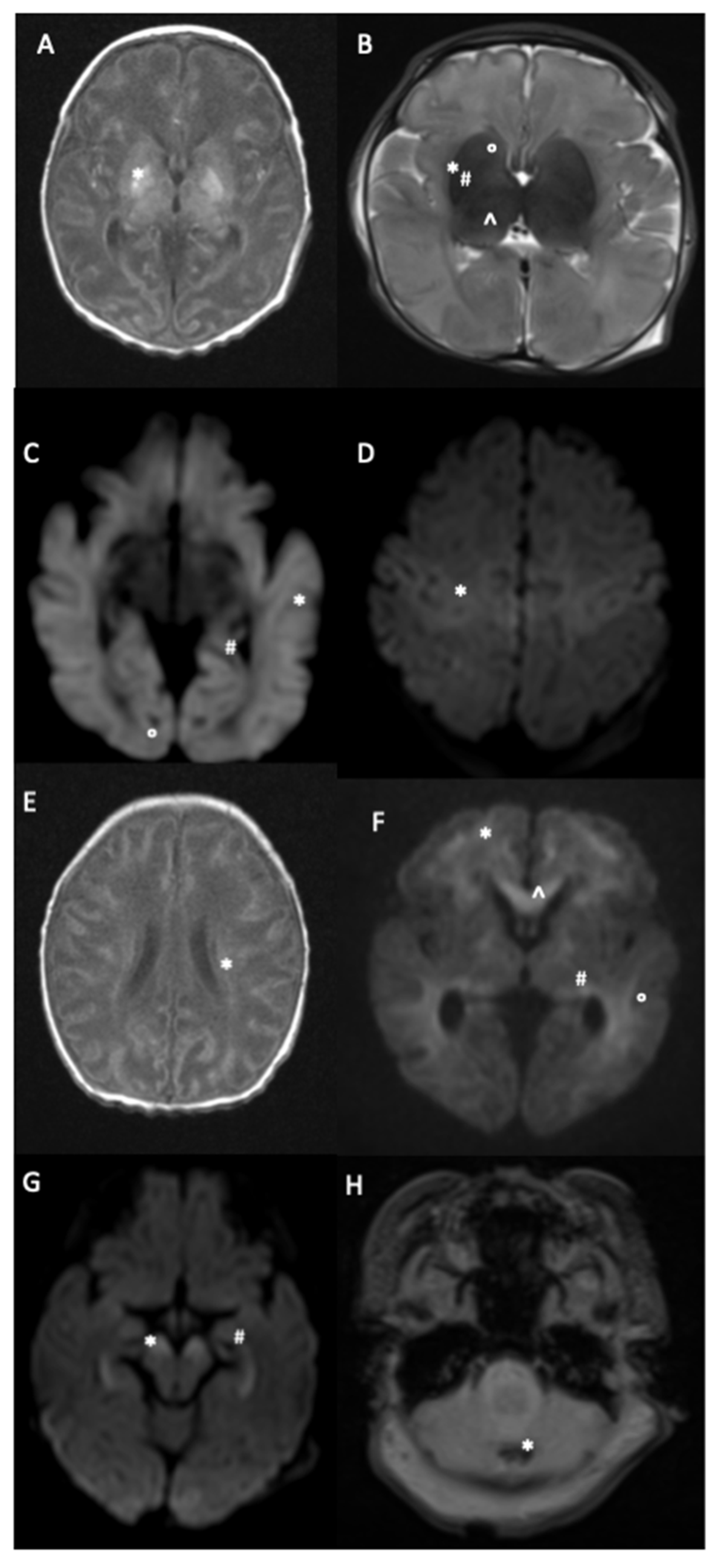 Children 09 00561 g002