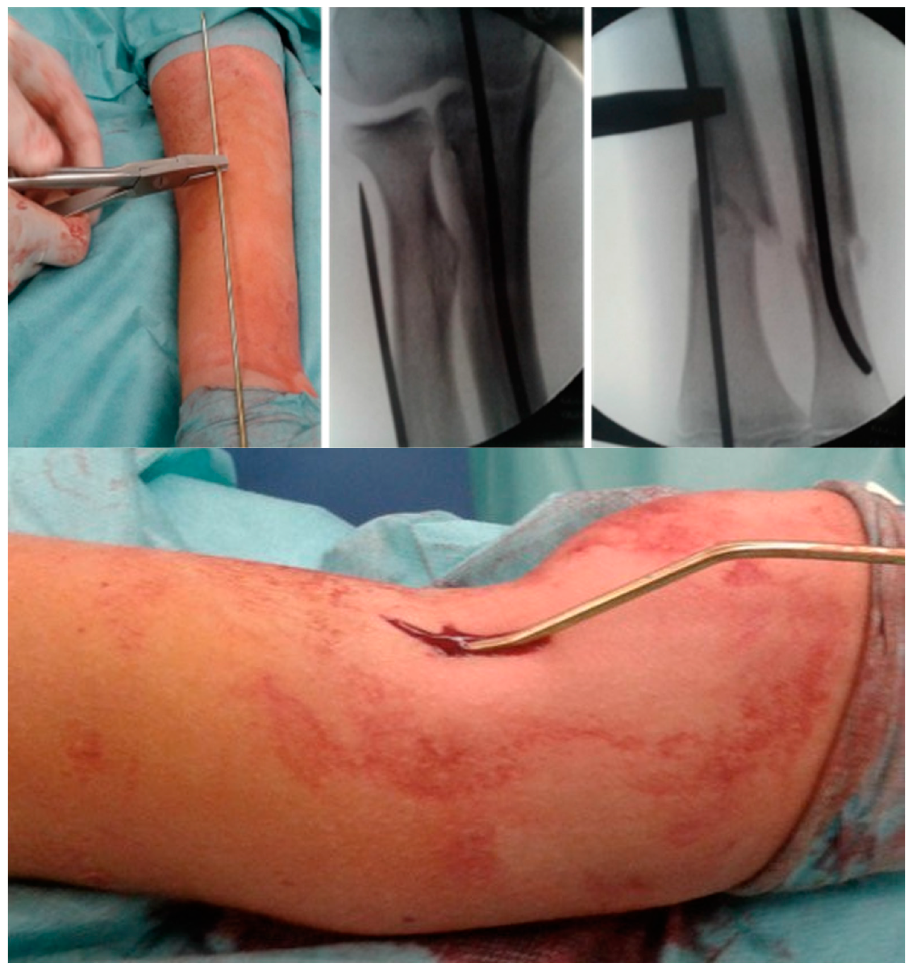 Children 09 00579 g002