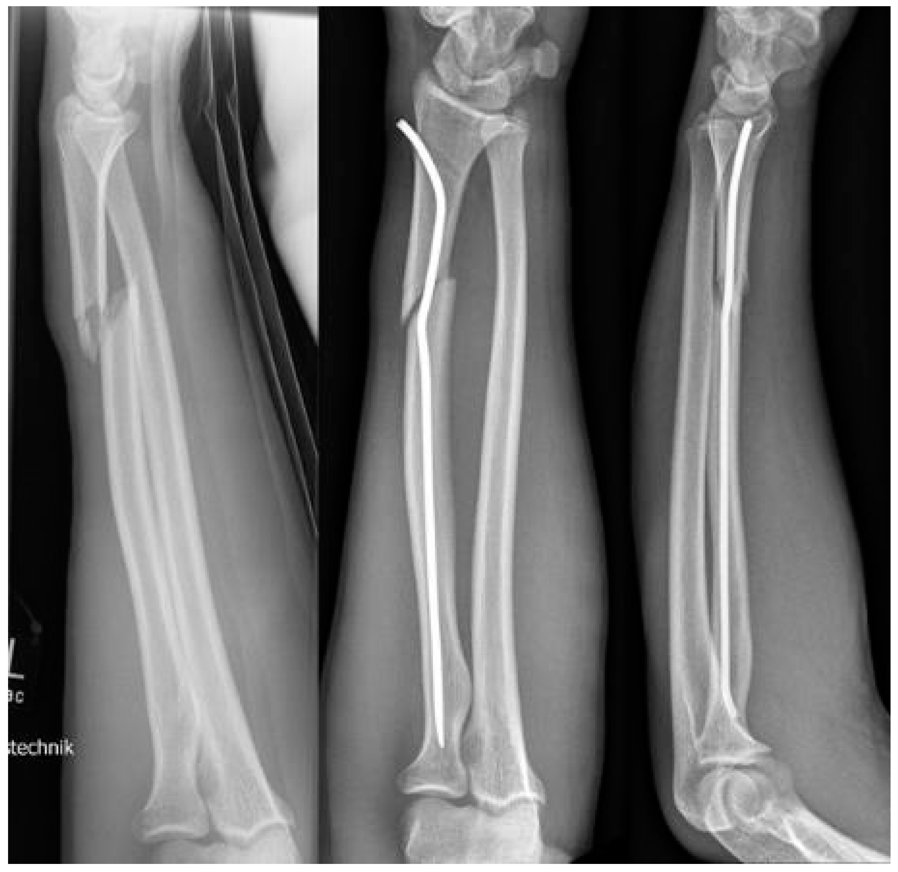 Children 09 00579 sch003