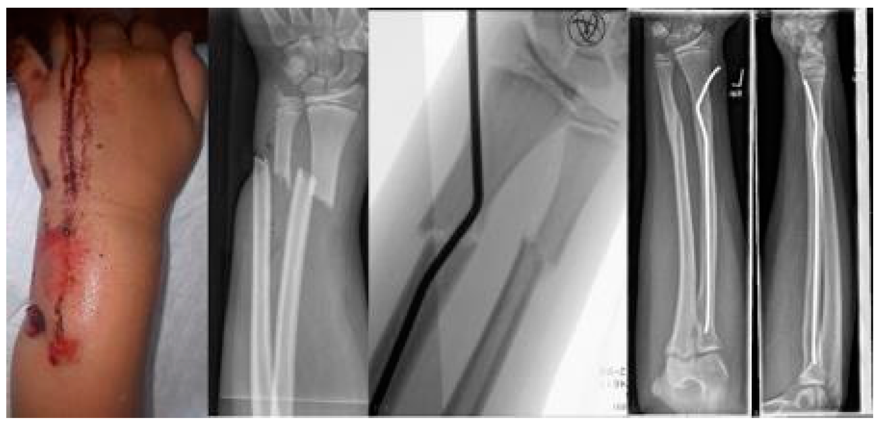 Children 09 00579 sch004