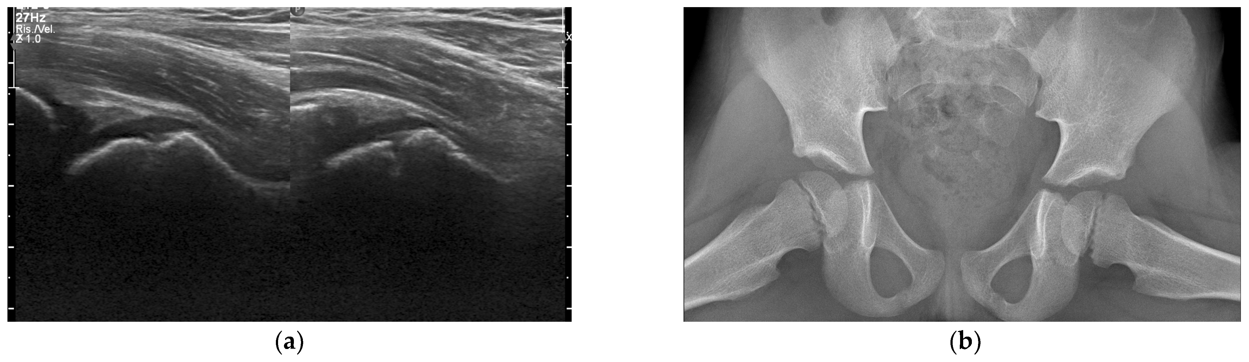 Children 09 00685 g003a