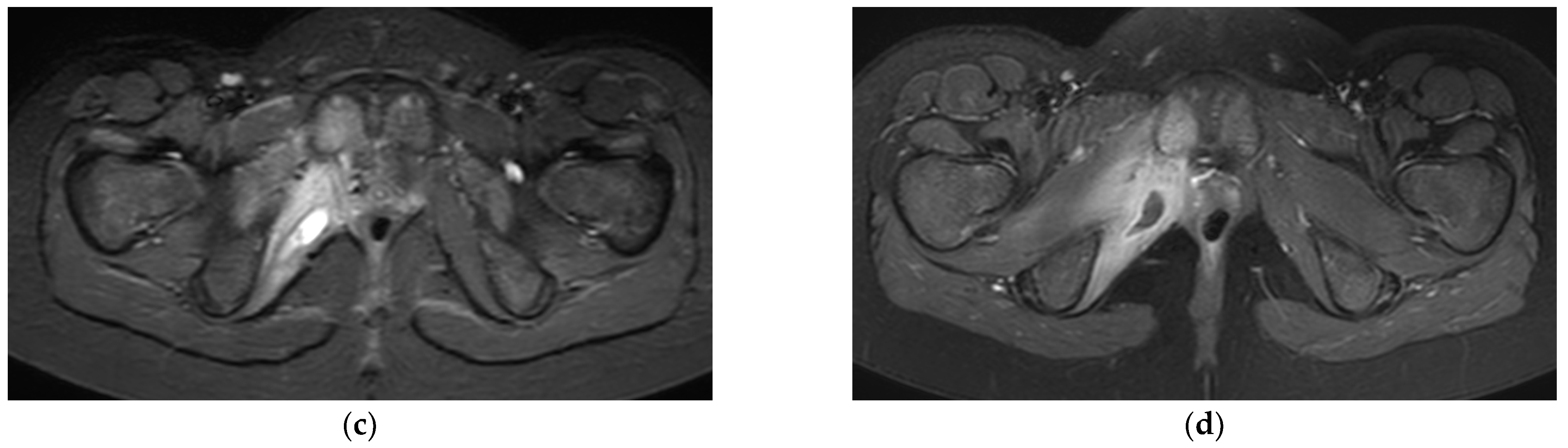 Children 09 00685 g003b