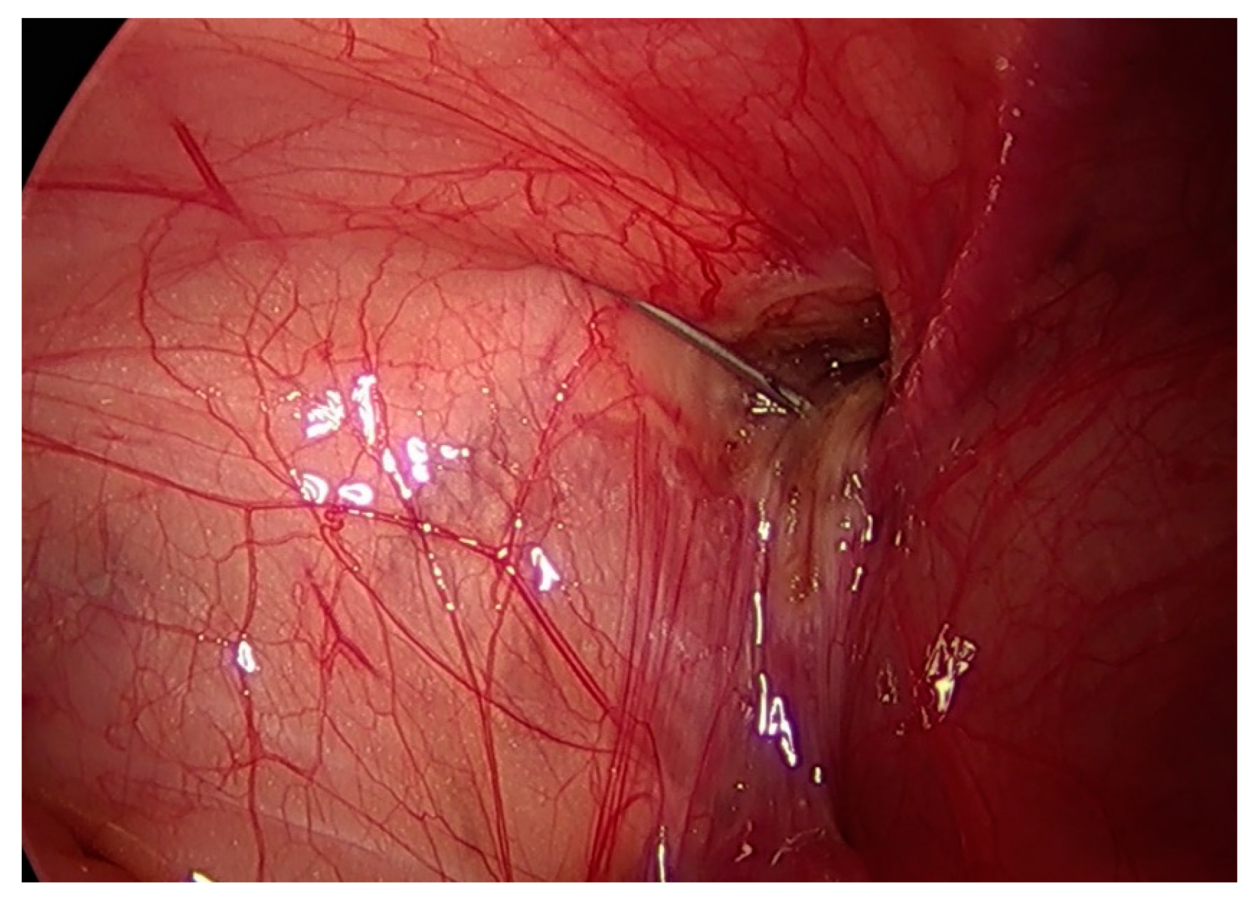 Children 09 00724 g003 Children 09 00724 g003