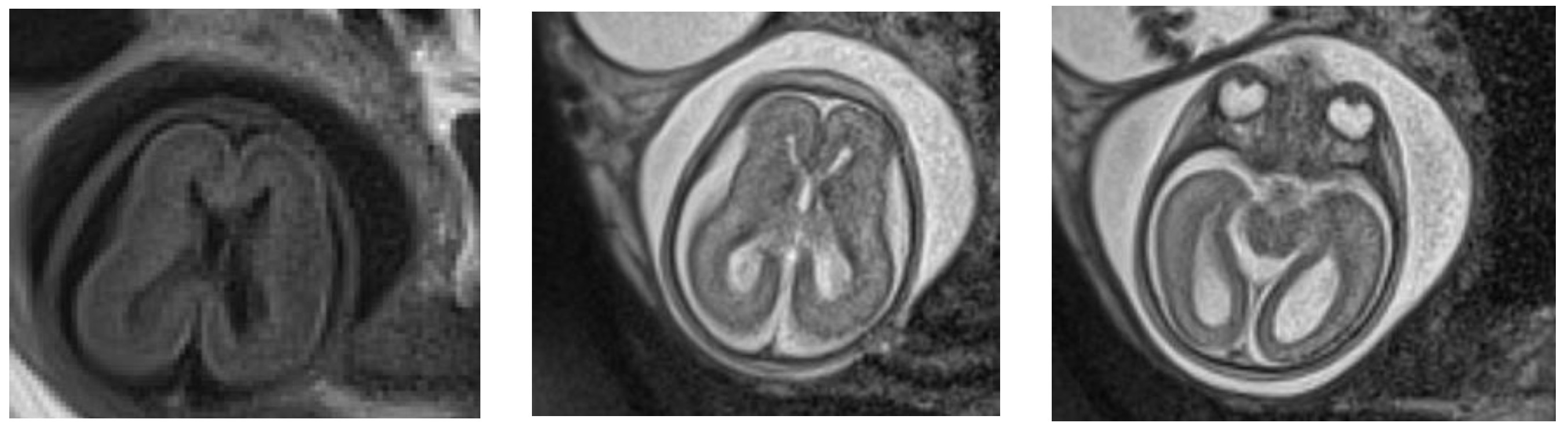 Children 09 00759 g001 Children 09 00759 g001