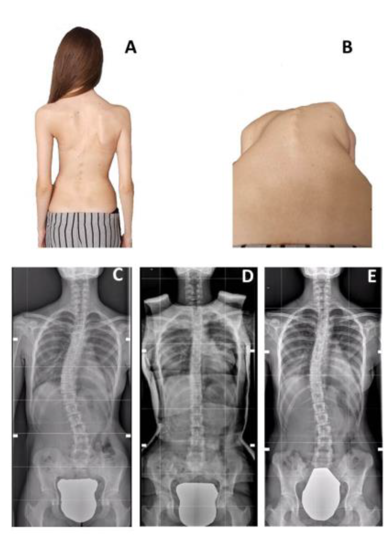 Children 09 00760 g002 Children 09 00760 g002