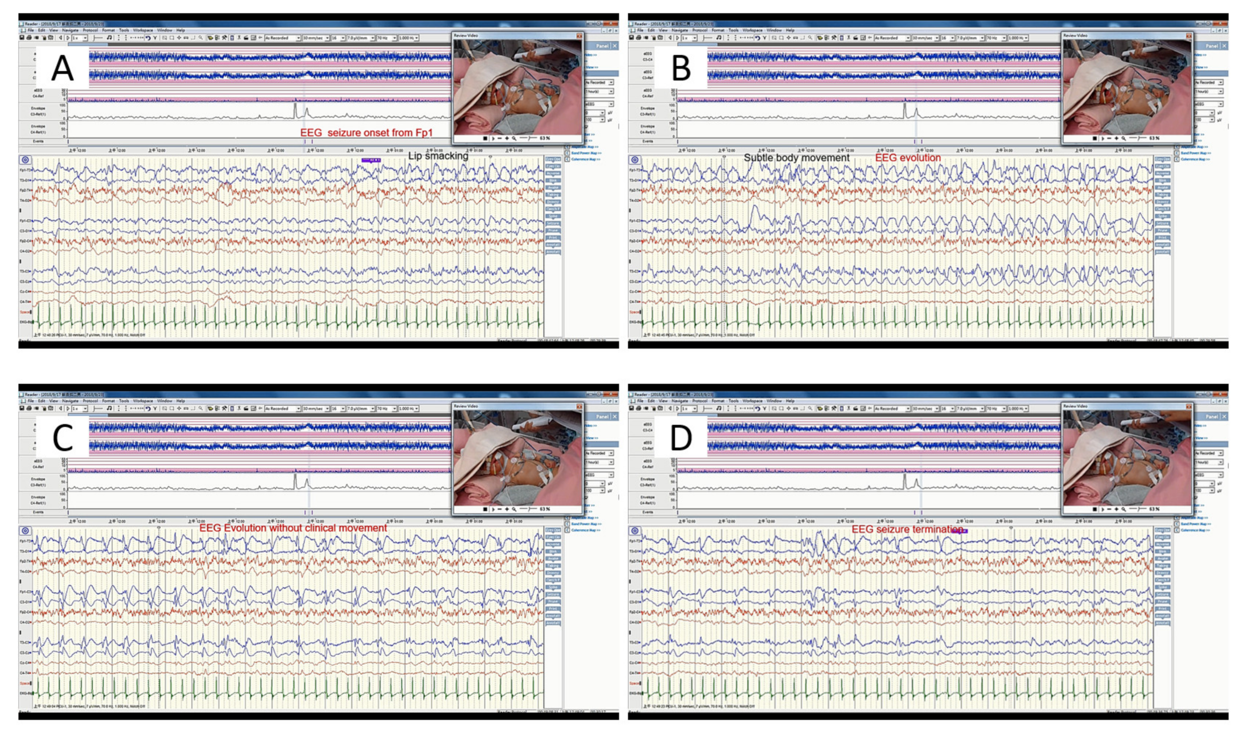 Children 09 00770 sch001