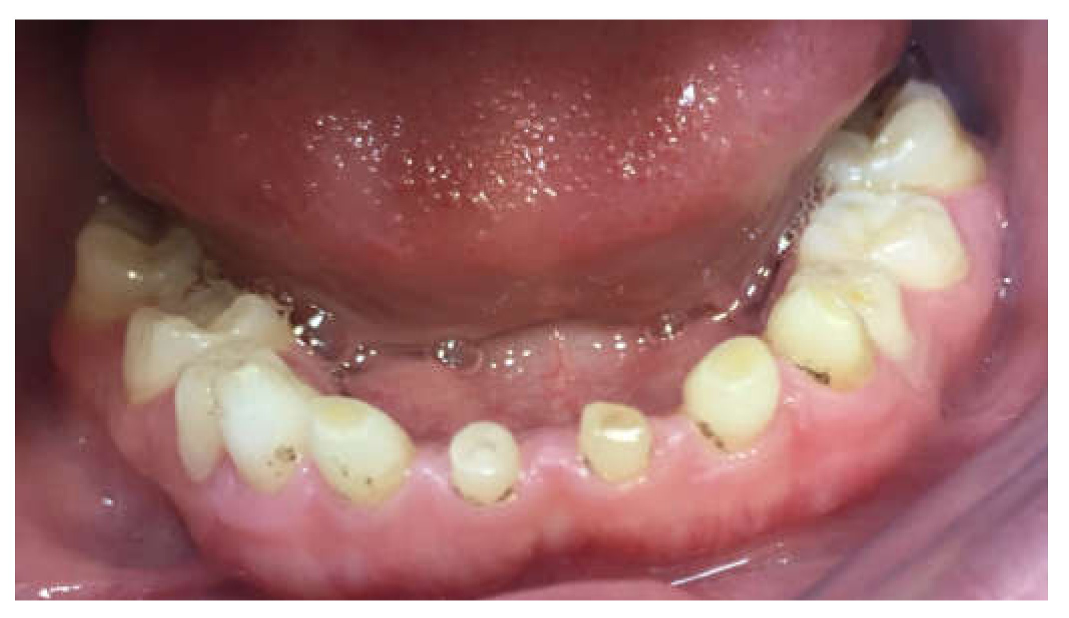 Children 09 00804 g006