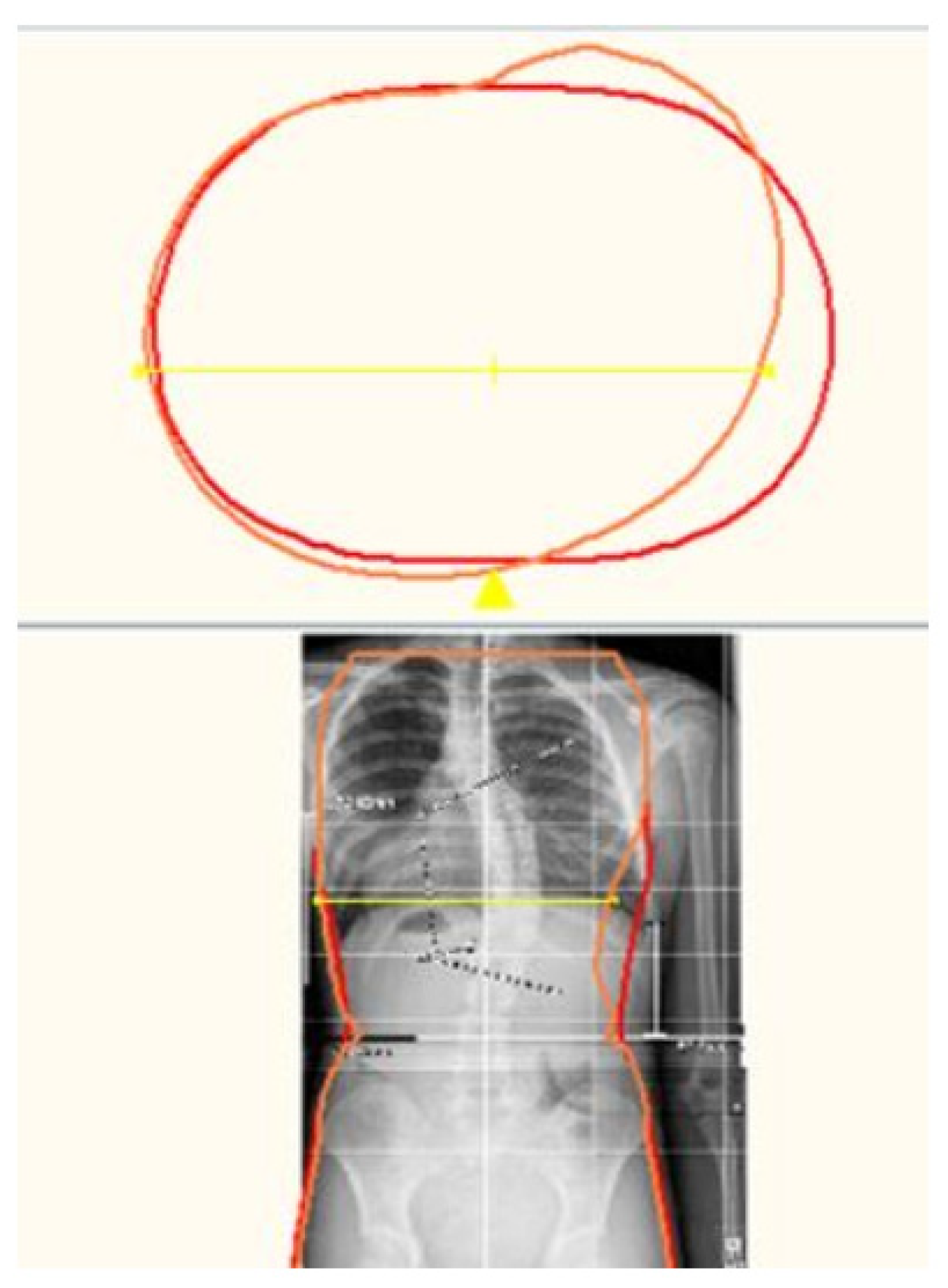 Children 09 00842 g006