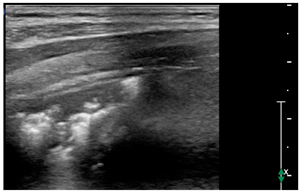 Children 09 00931 i005 Children 09 00931 i005