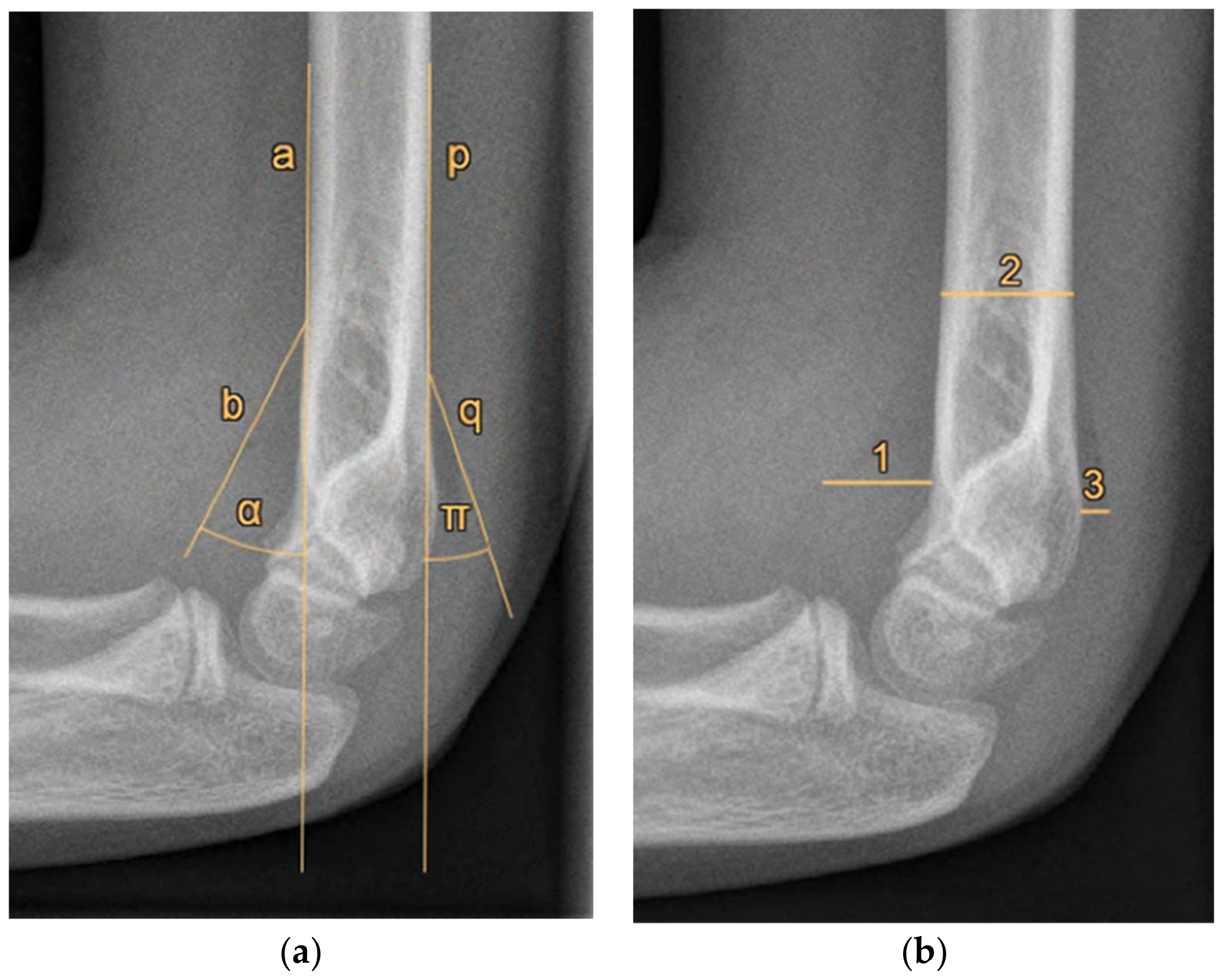 Children 09 00950 g001