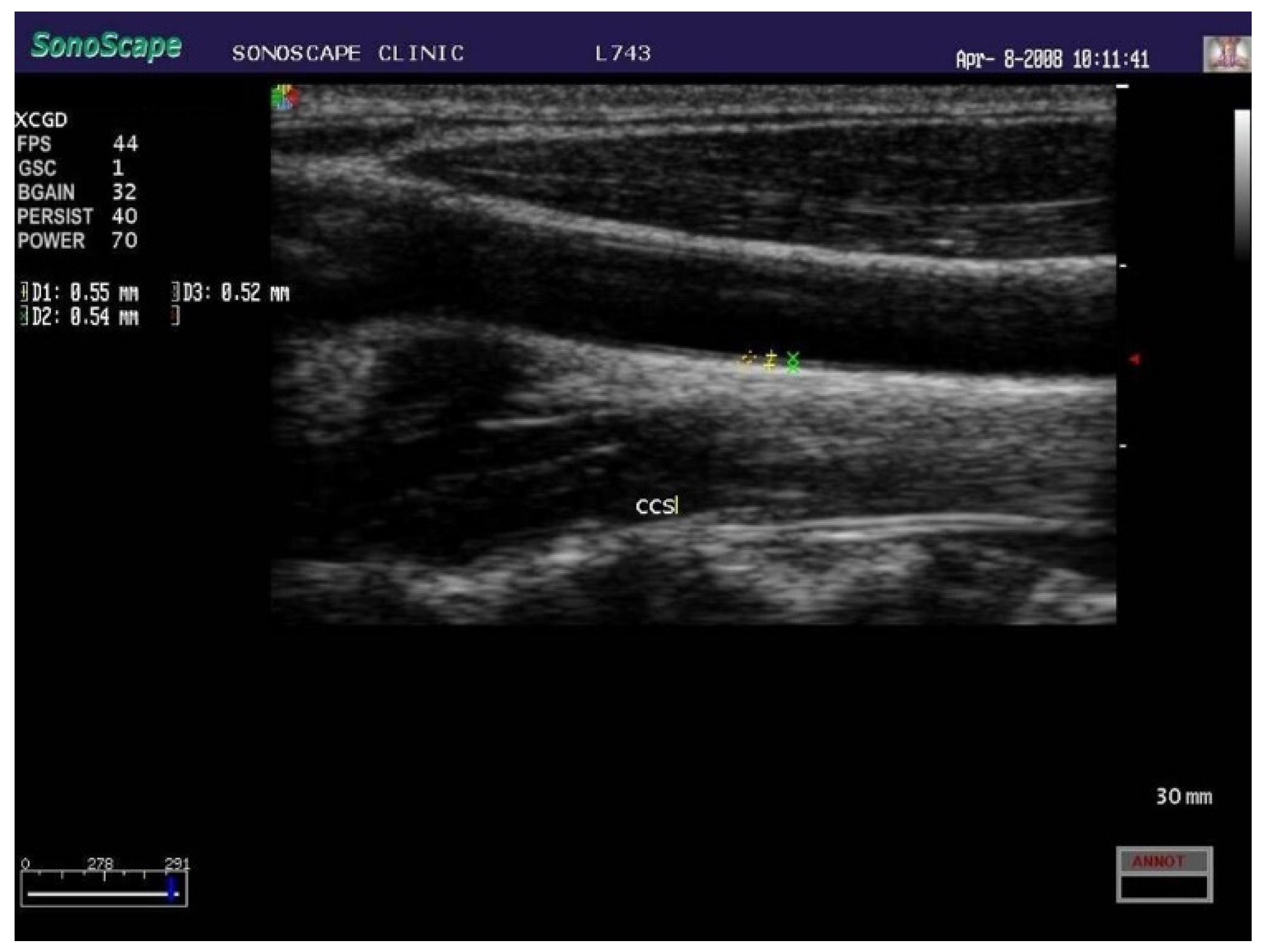 Children 09 00982 g004