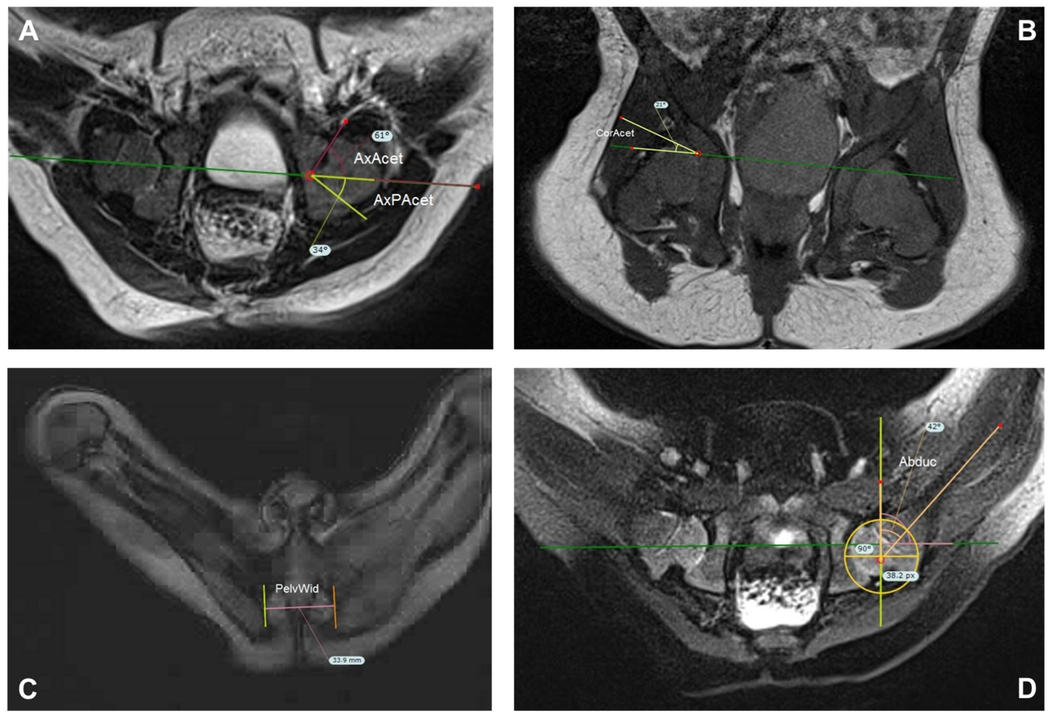 Children 09 01010 g004