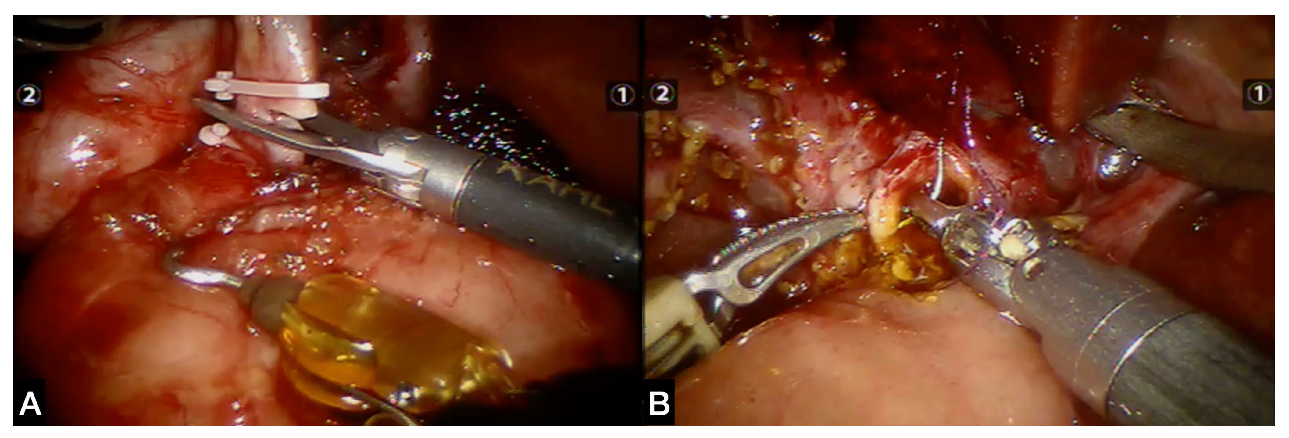 Children 09 01021 g003