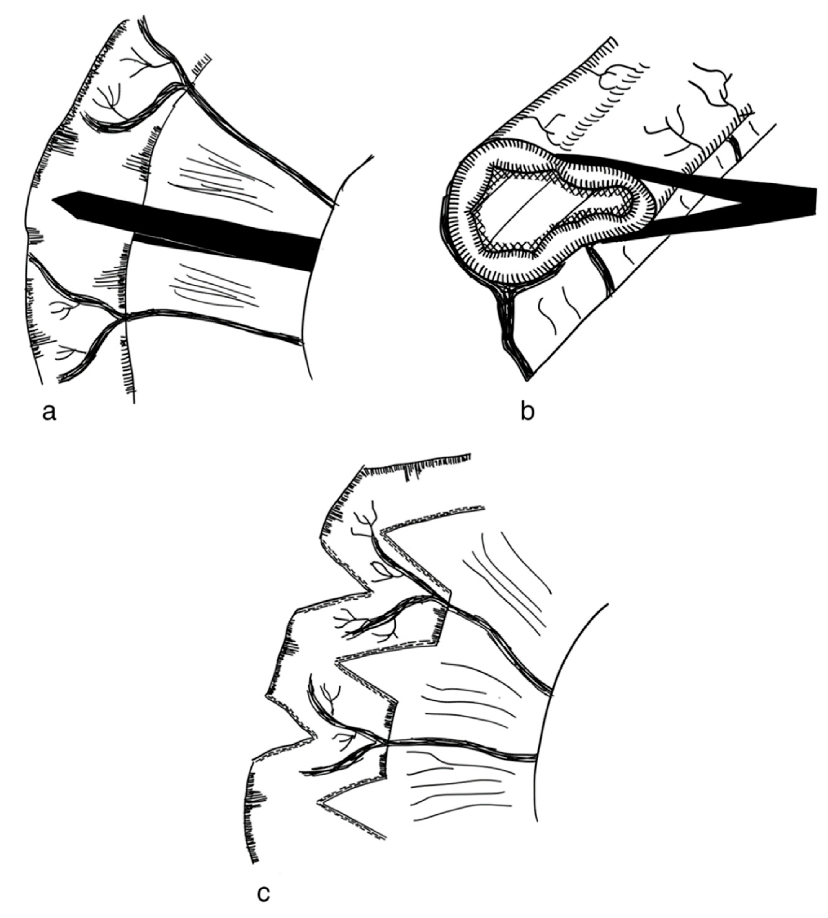 Children 09 01024 g002 Children 09 01024 g002