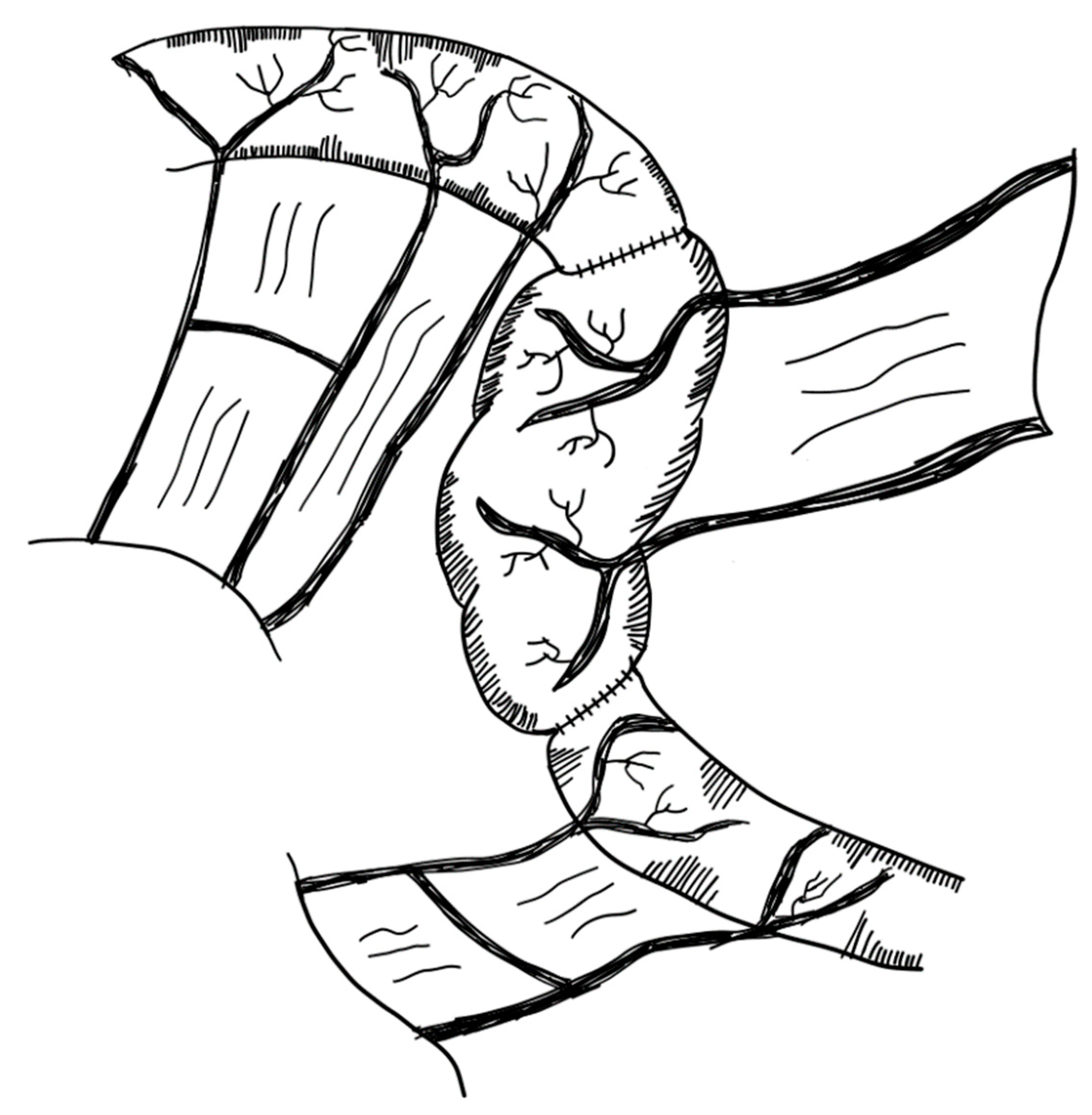 Children 09 01024 g012 Children 09 01024 g012