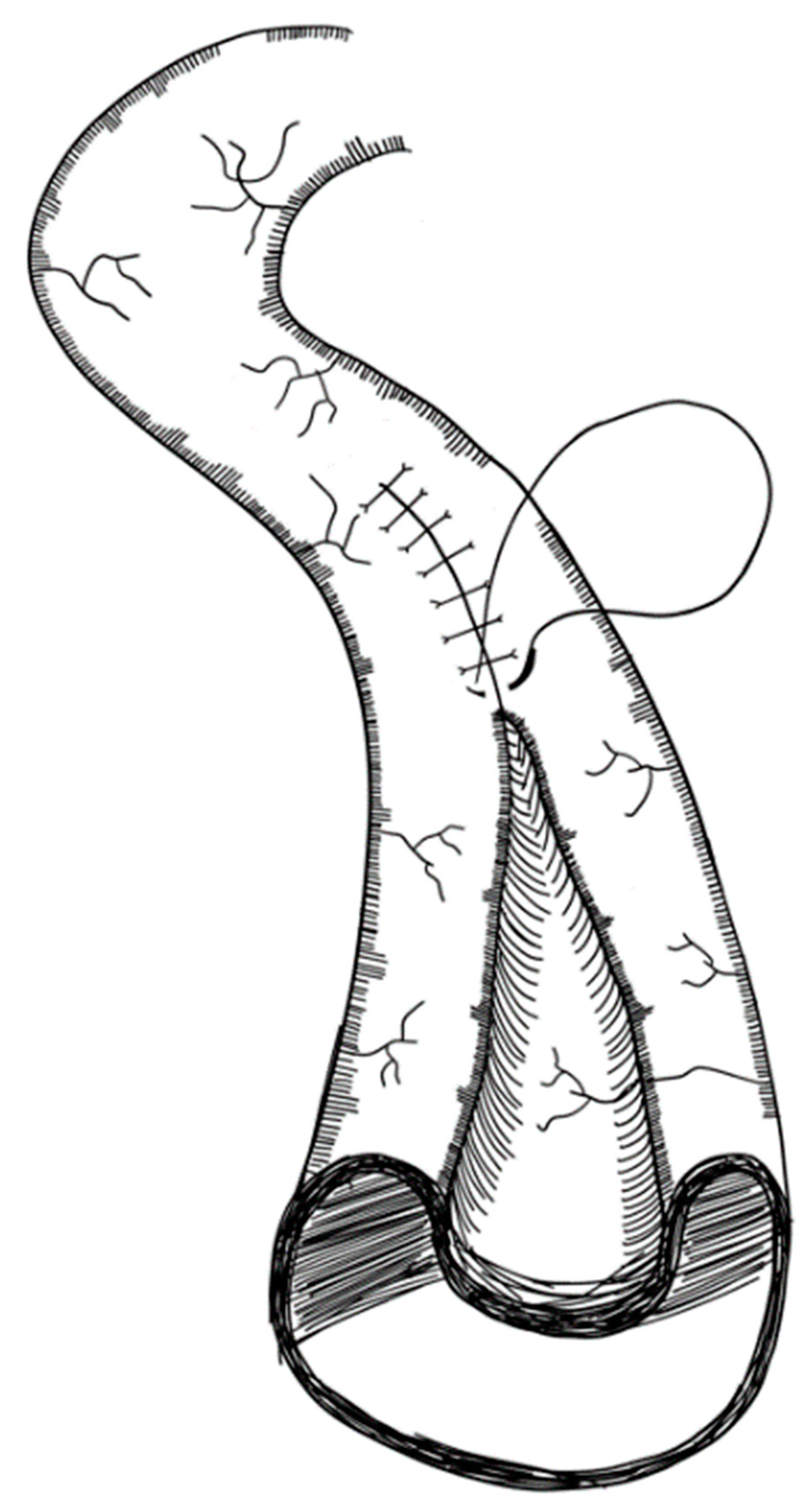 Children 09 01024 g015 Children 09 01024 g015