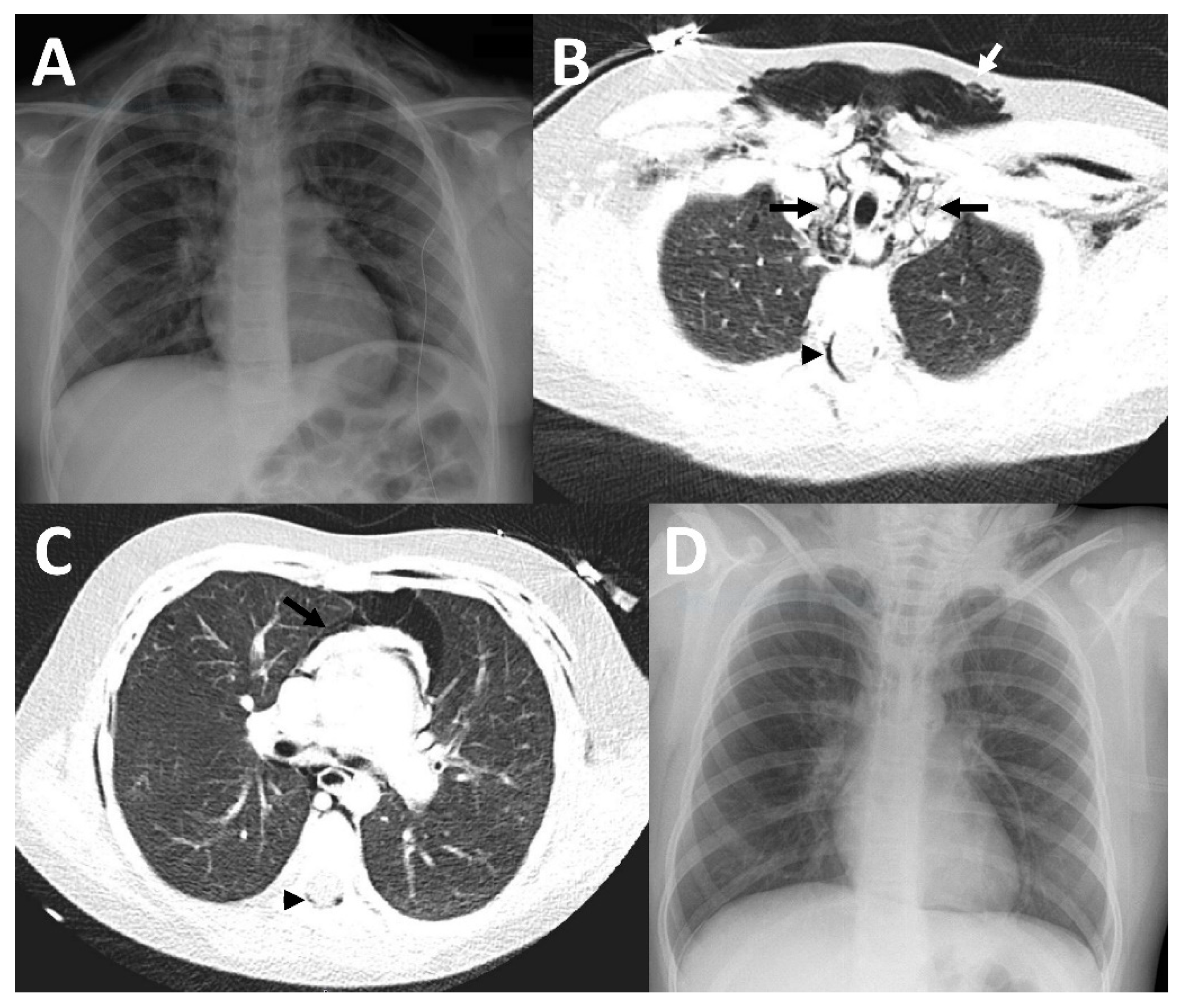 Children 09 01040 g003