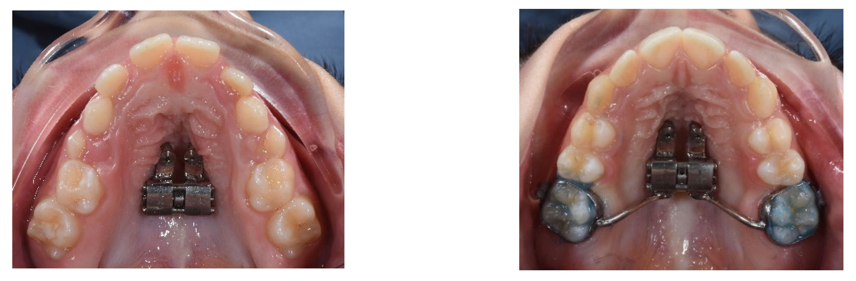 Children 09 01046 g002