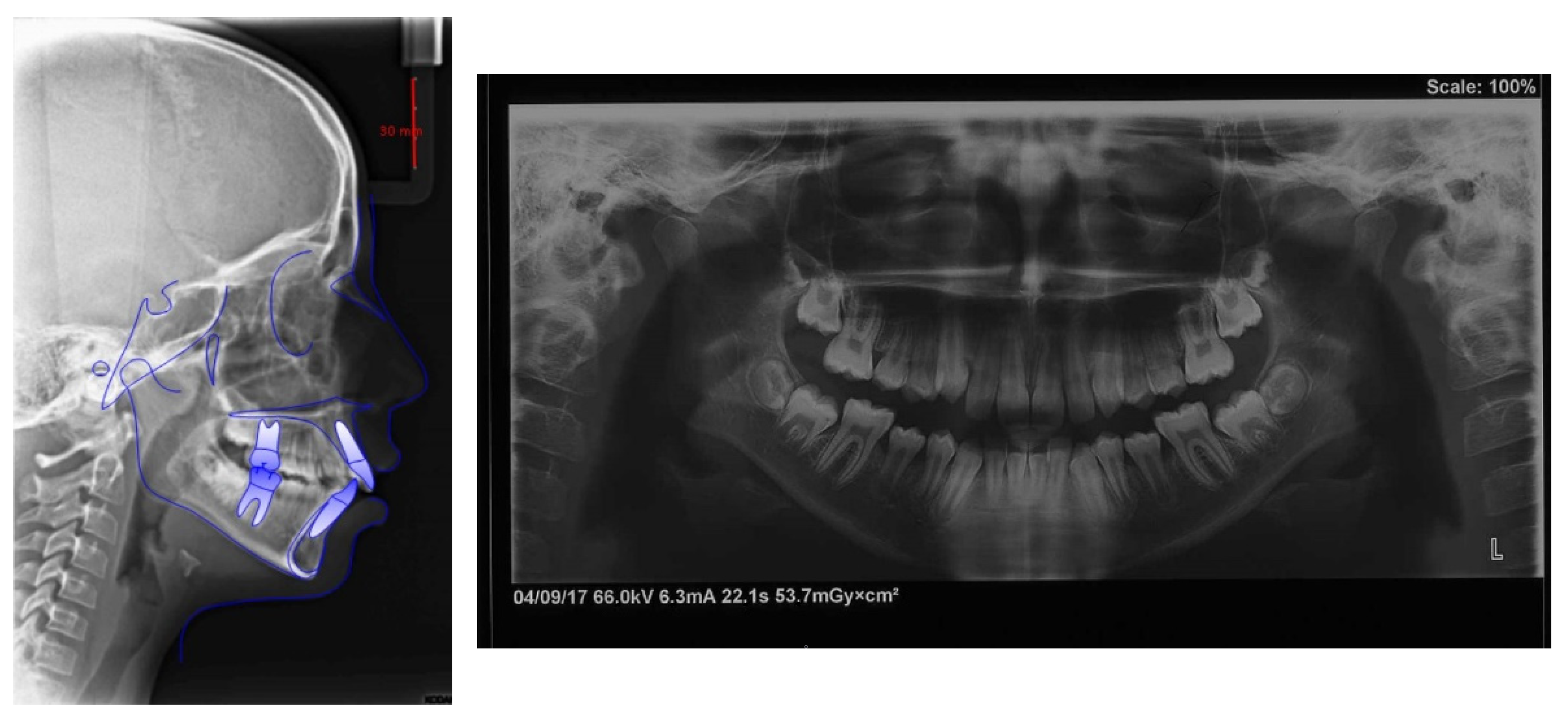 Children 09 01046 g006