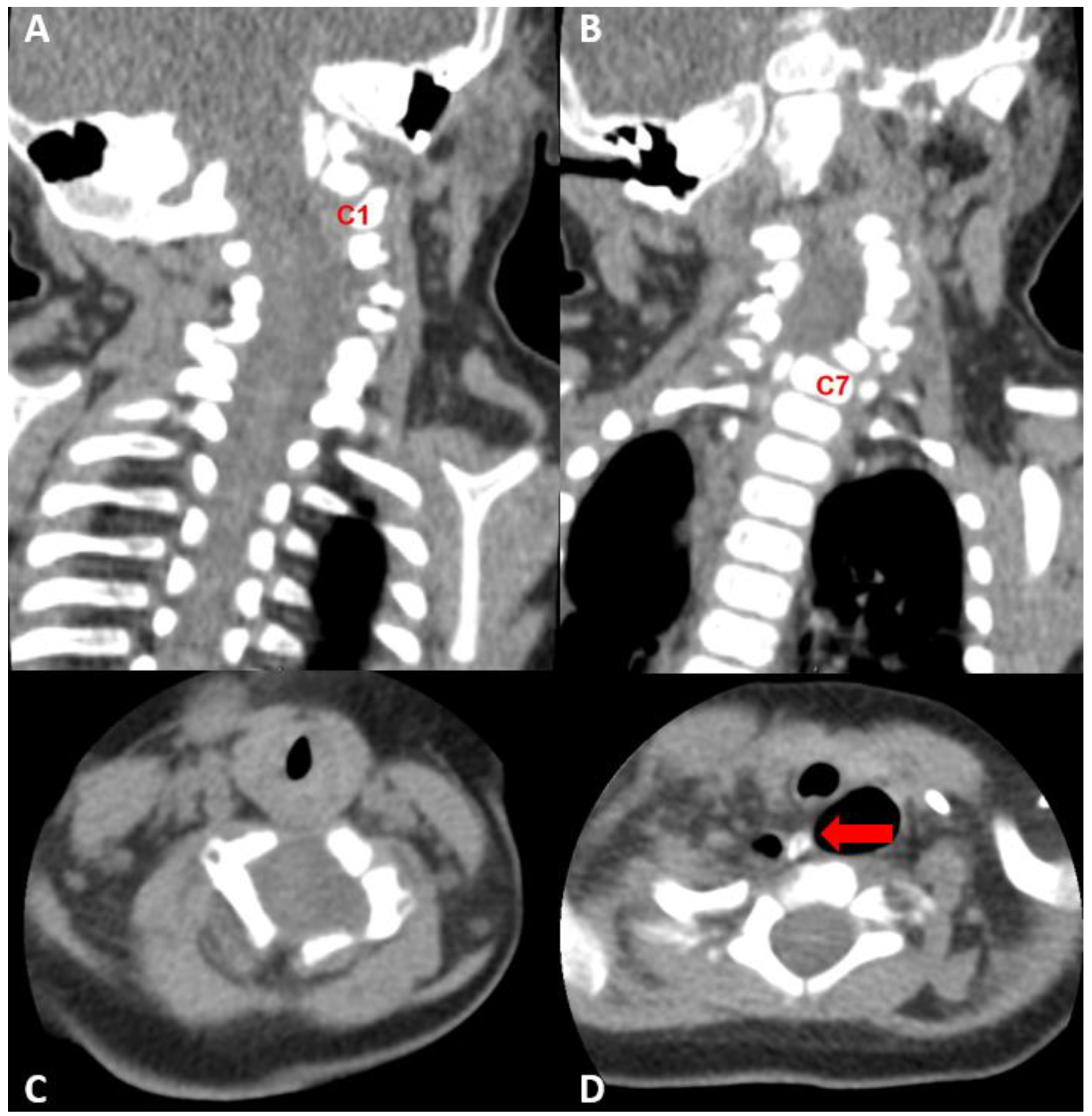 Children 09 01085 g002