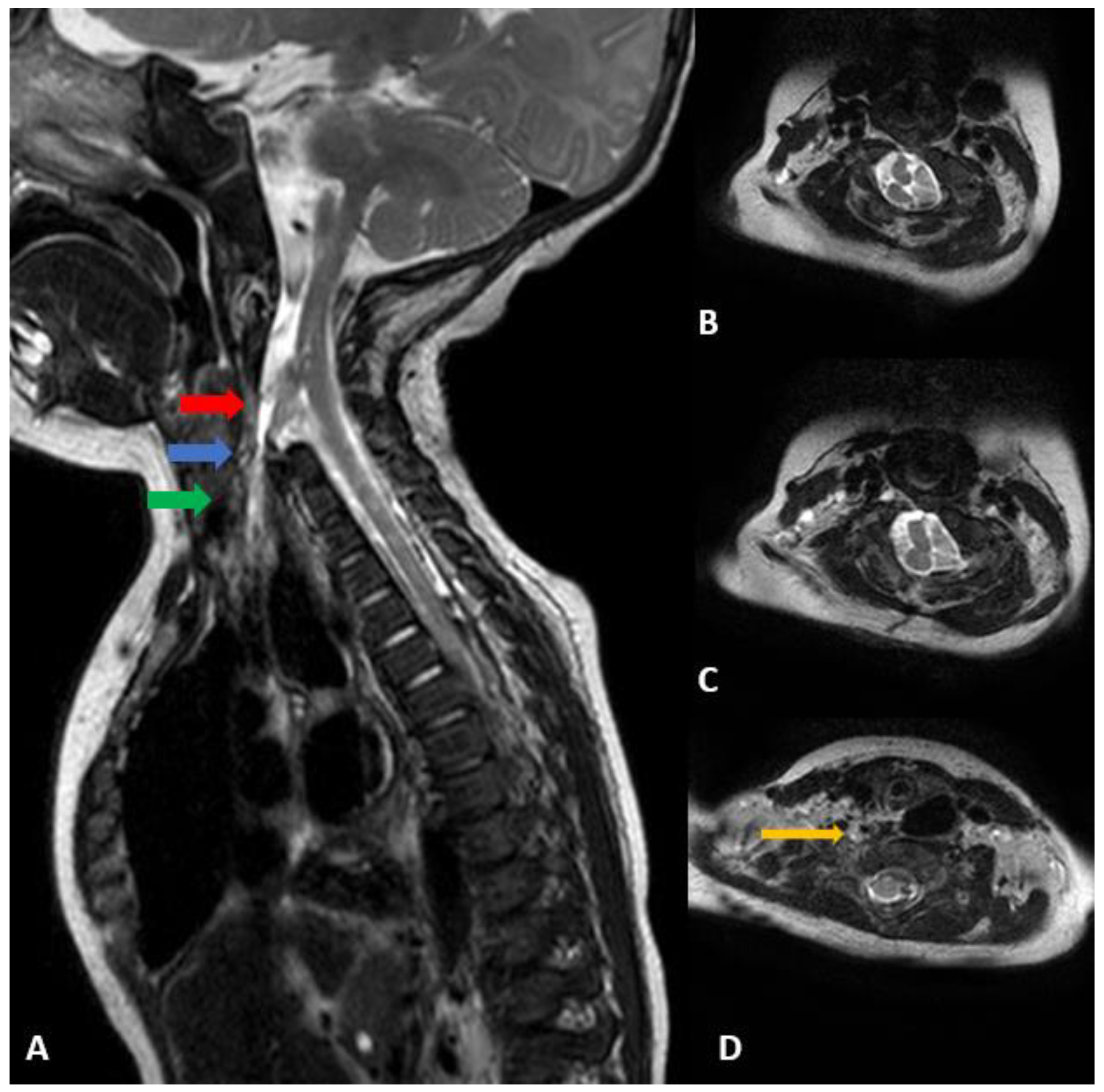 Children 09 01085 g003