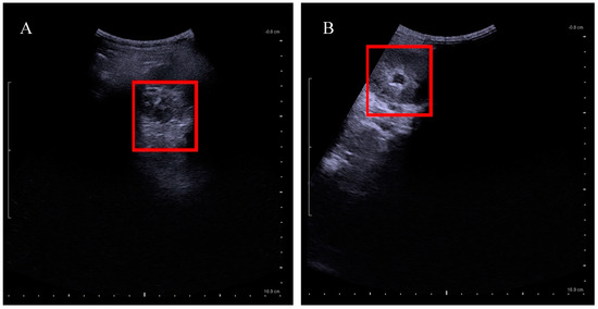 Children 09 01090 g0a1