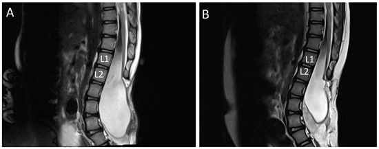 Children 09 01090 g0a2