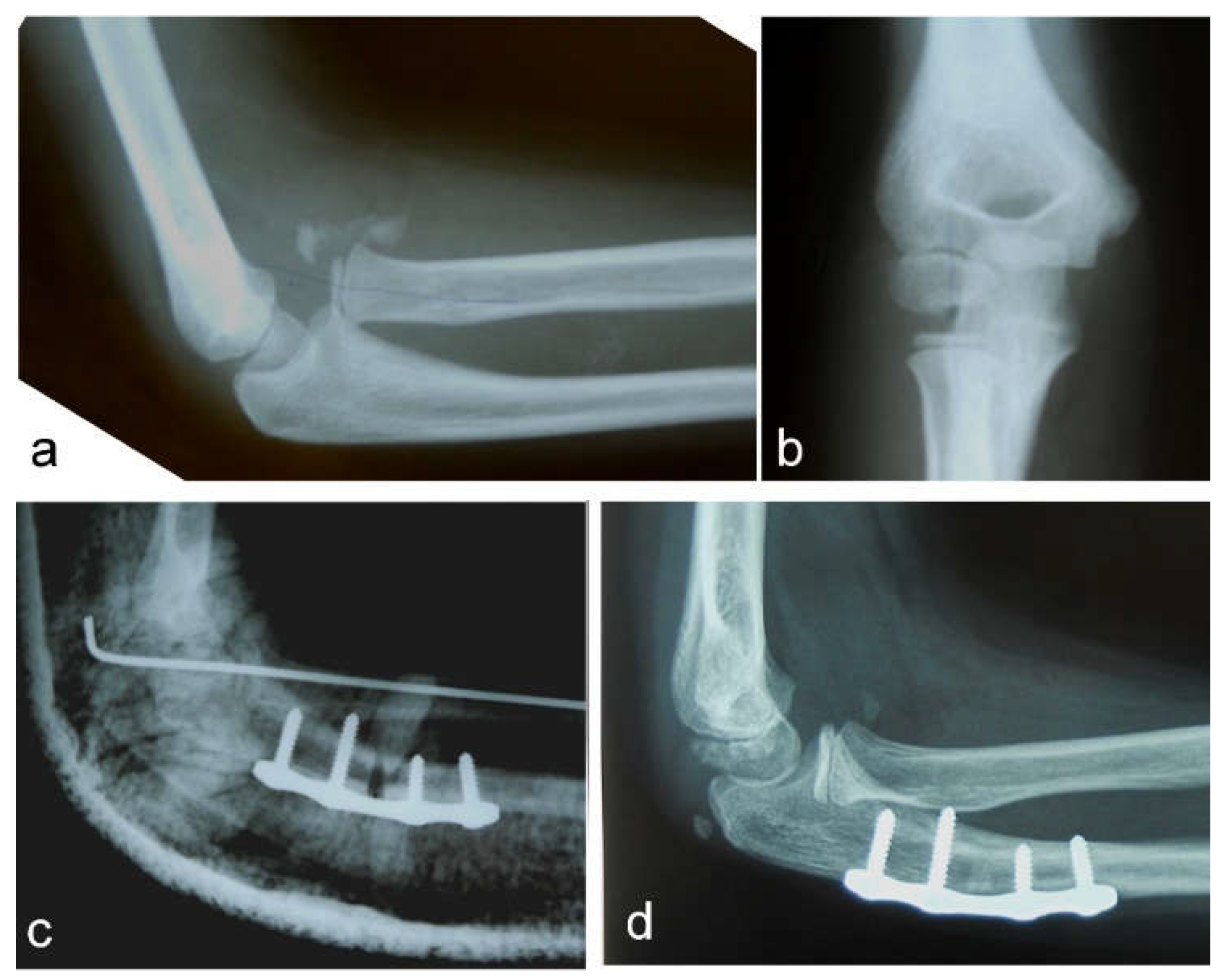 Children 09 01100 g001 Children 09 01100 g001