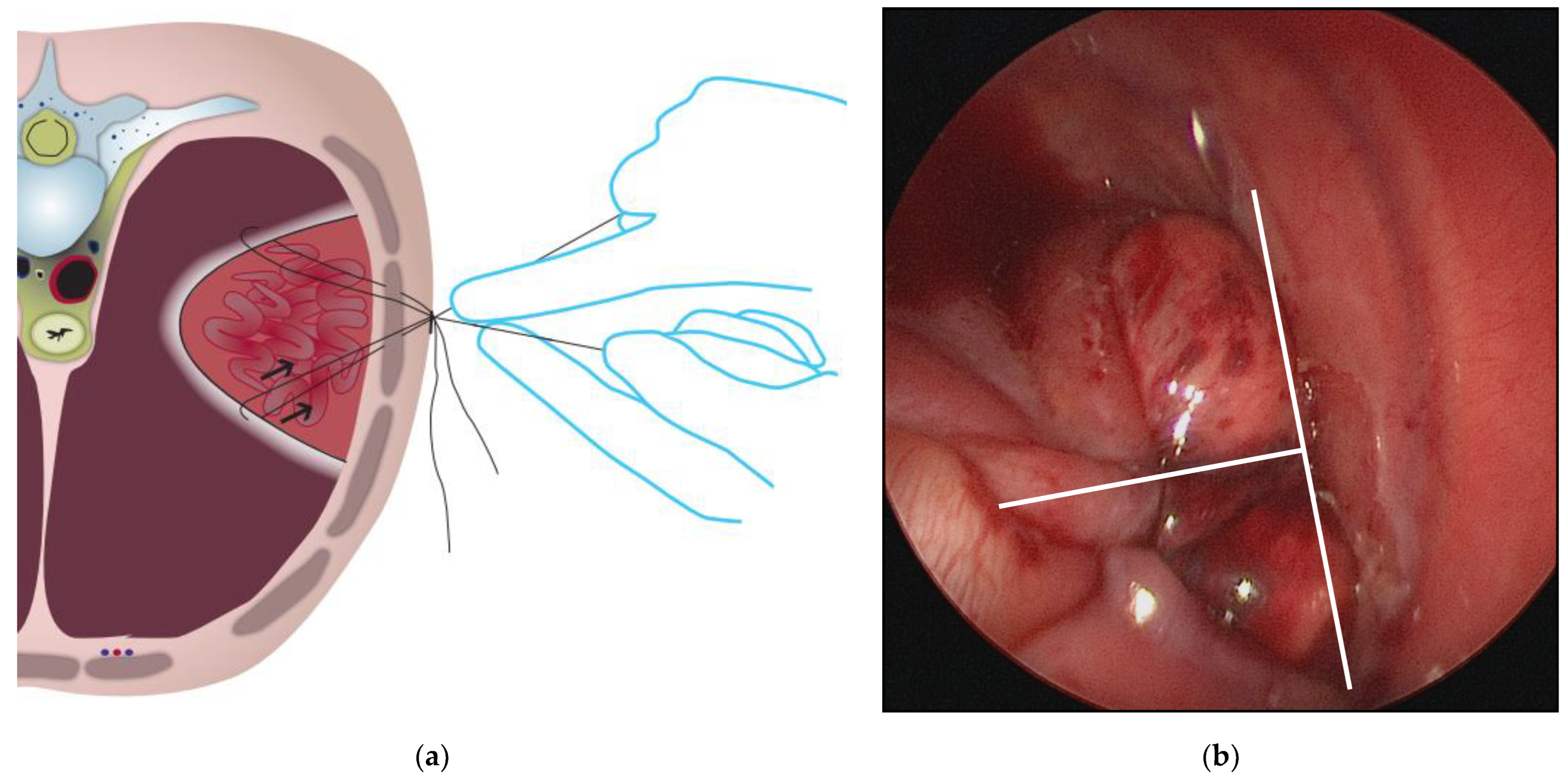 Children 09 01116 g003