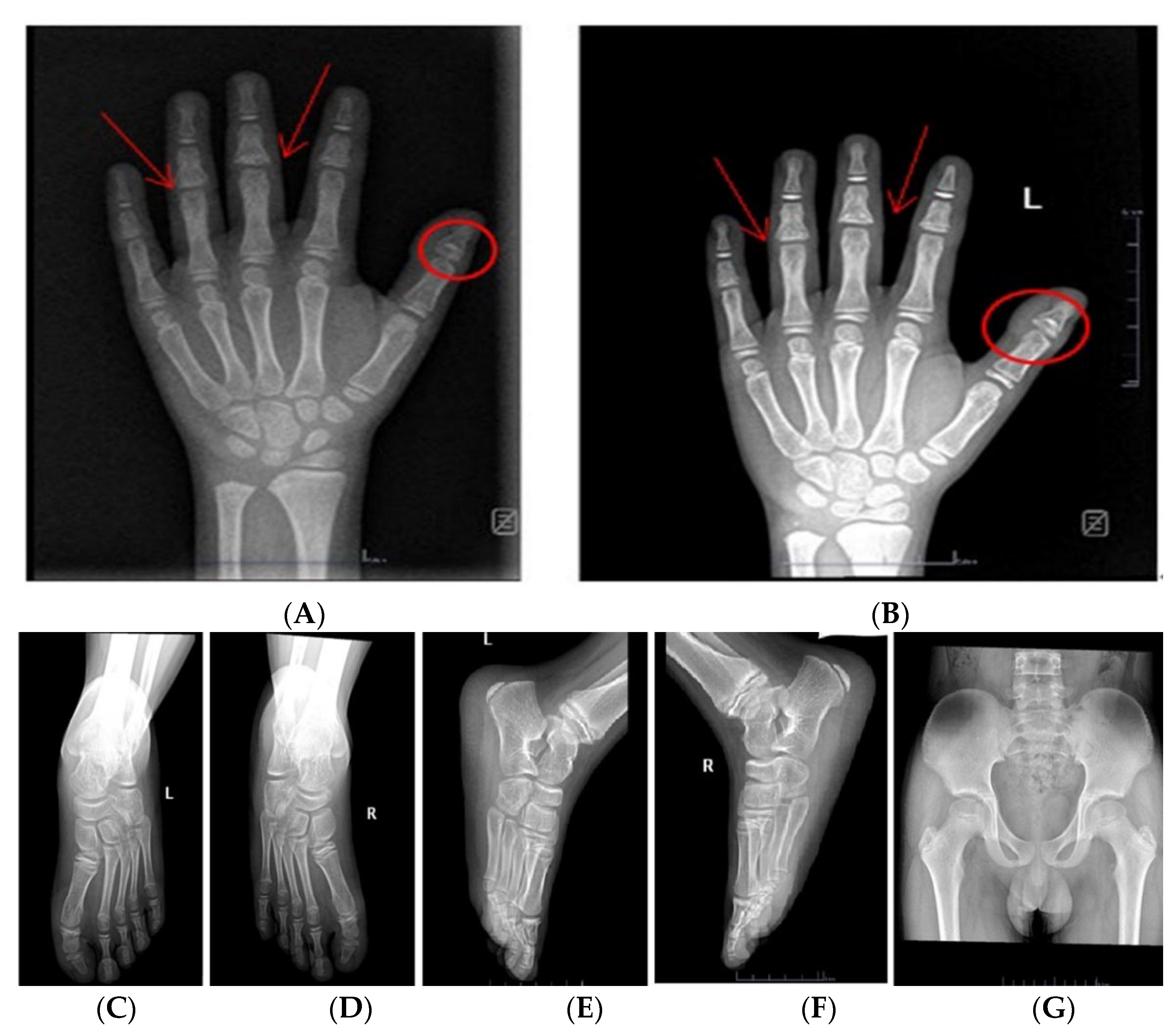 Children 09 01447 g002 Children 09 01447 g002