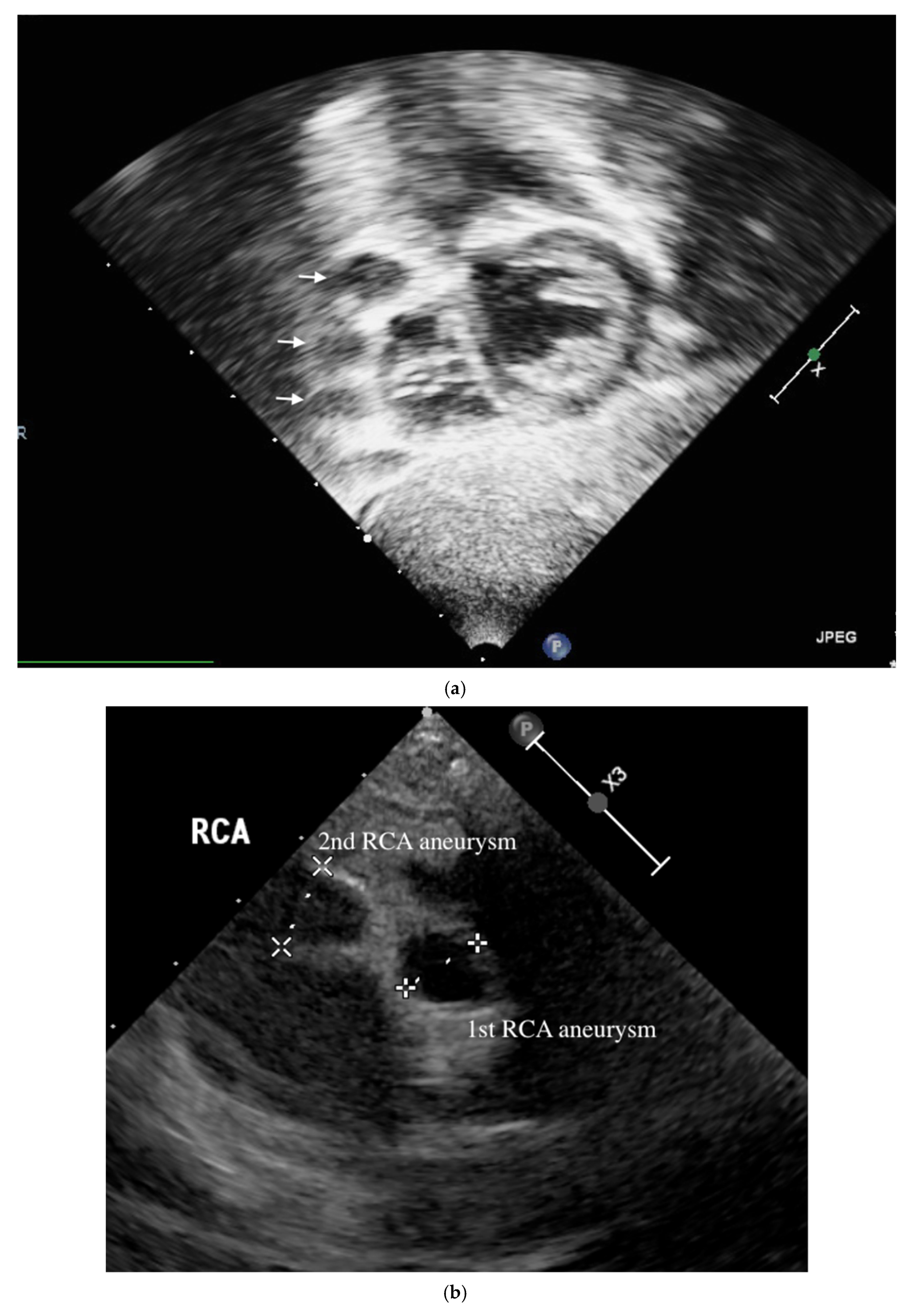 Children 09 01463 g001a