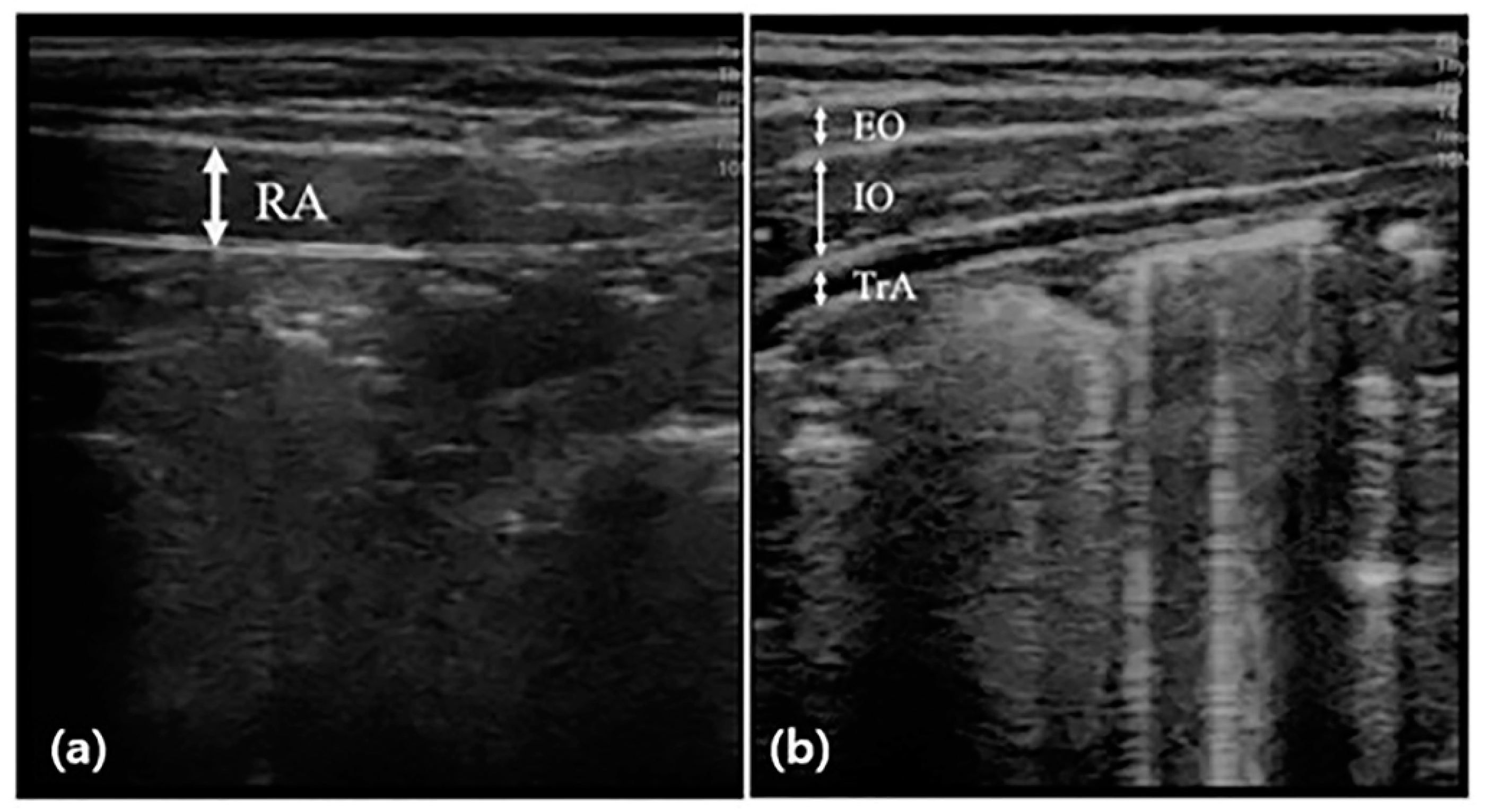 Children 09 01470 g001