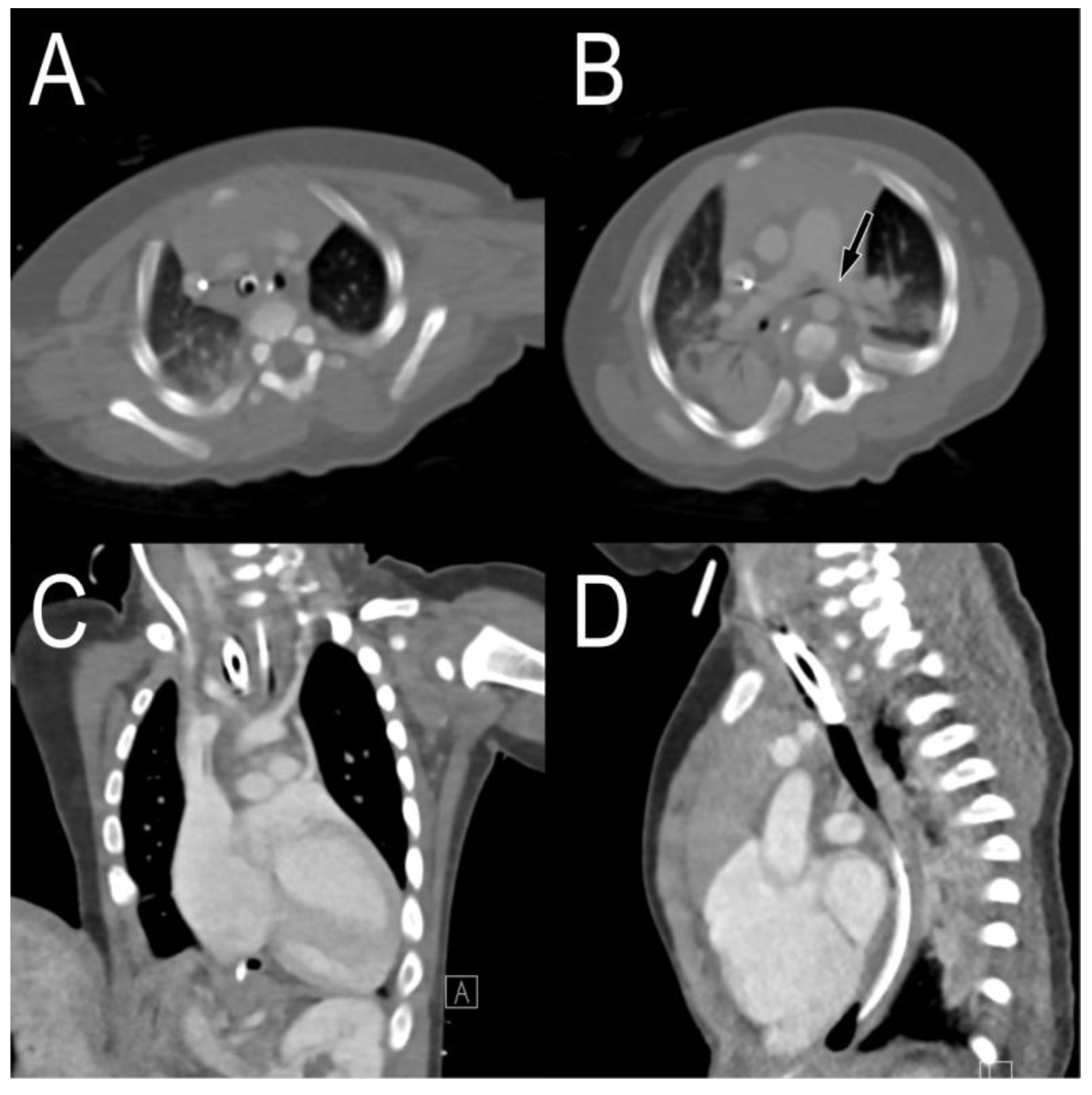 Children 09 01603 g003