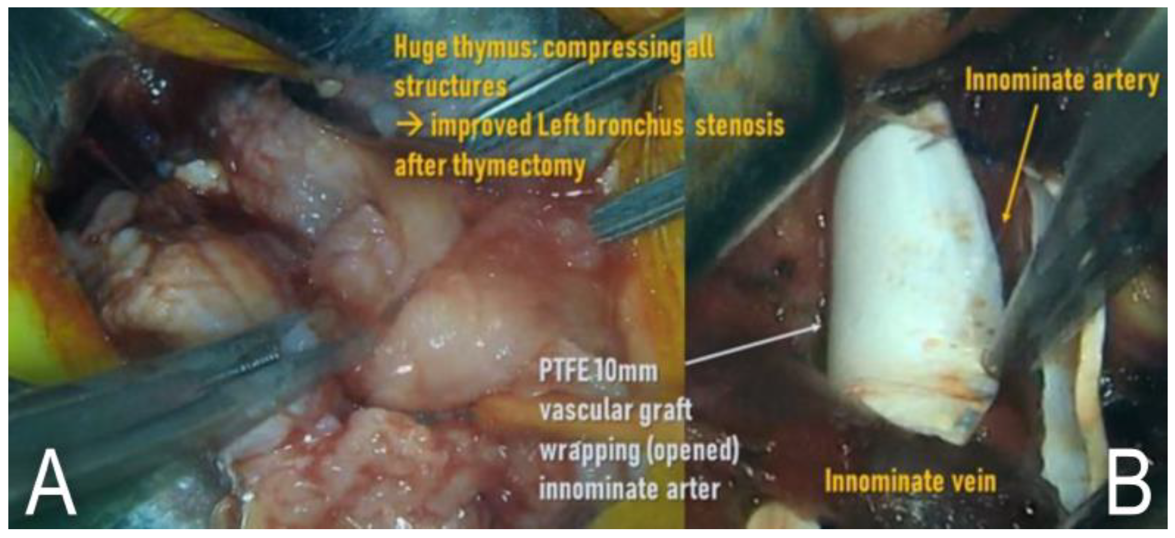 Children 09 01603 g004