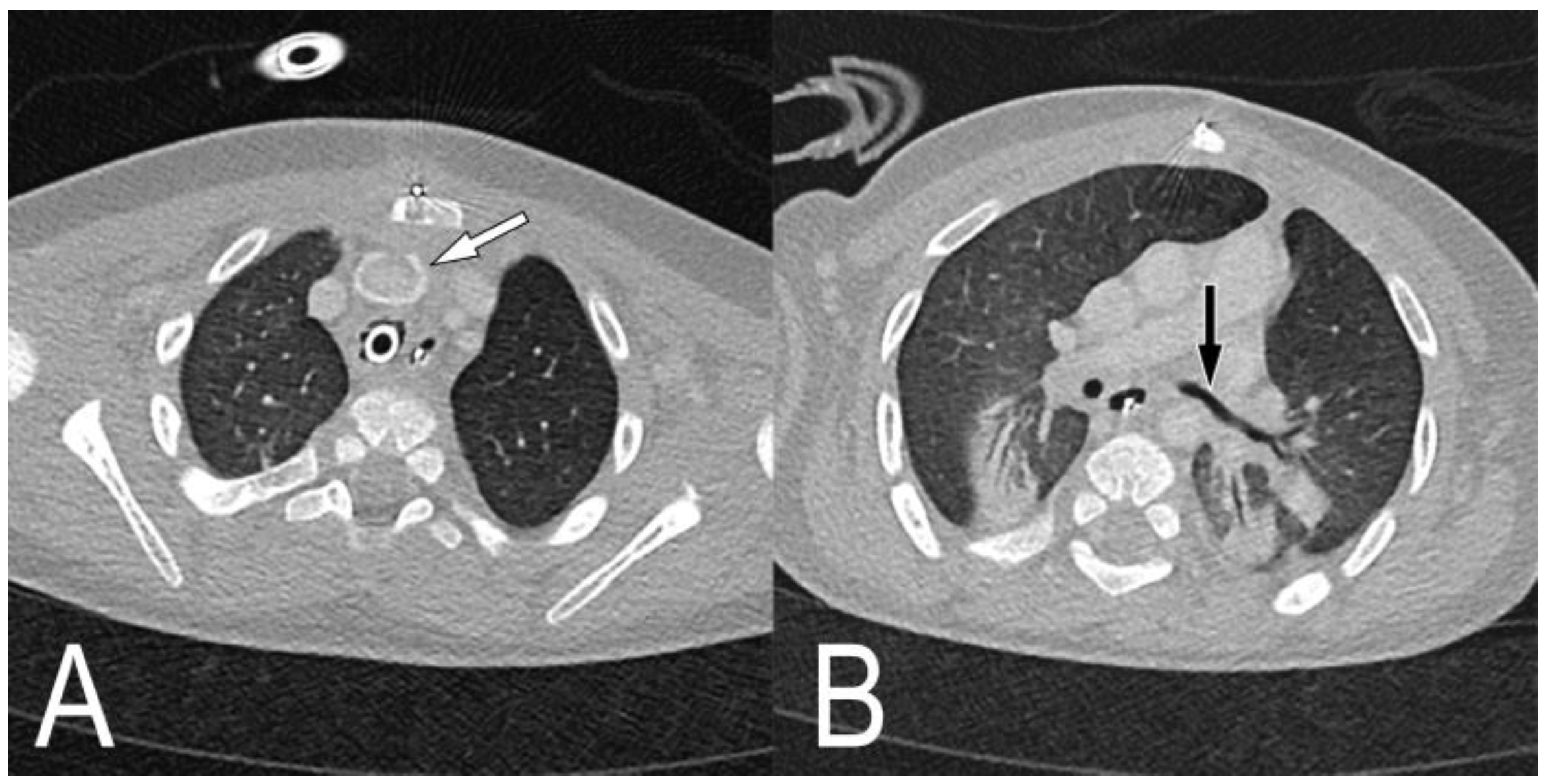 Children 09 01603 g005