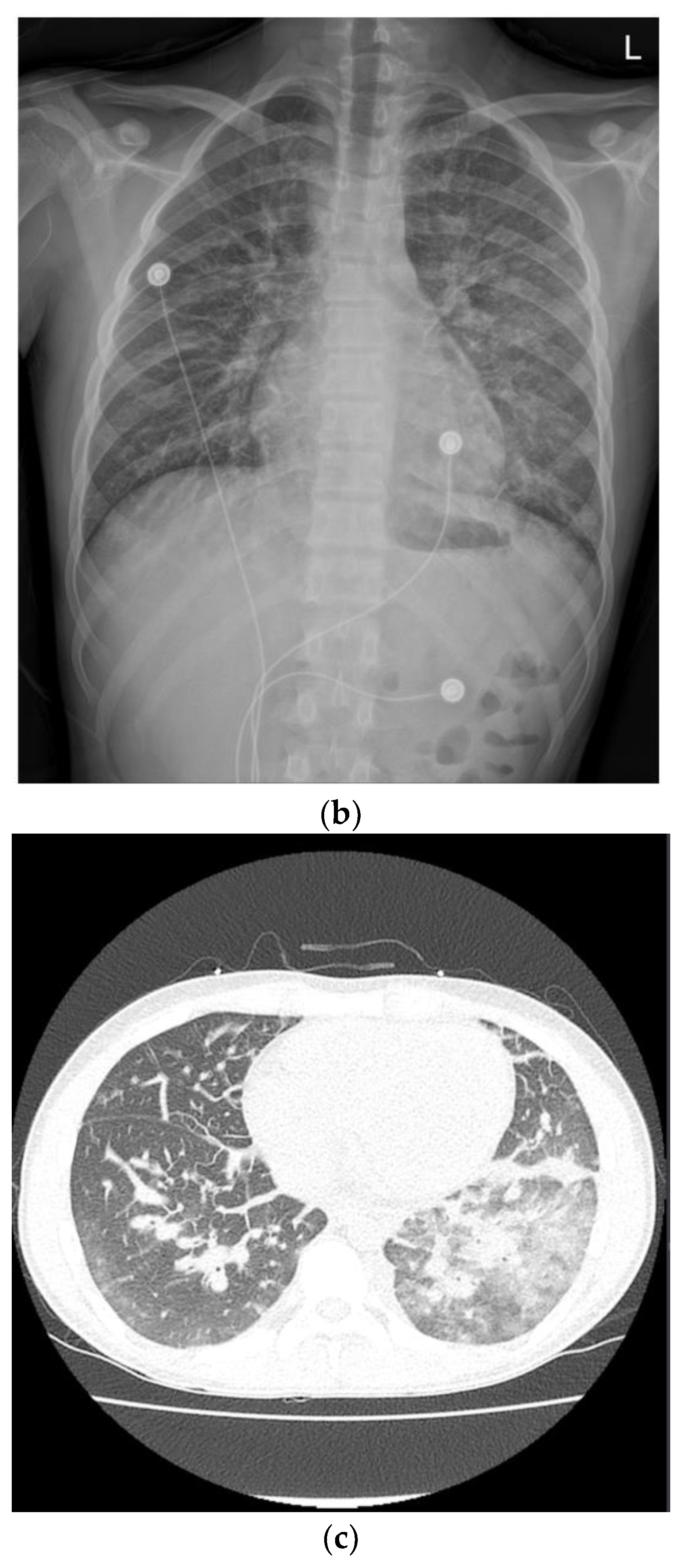 Children 09 01663 g001b