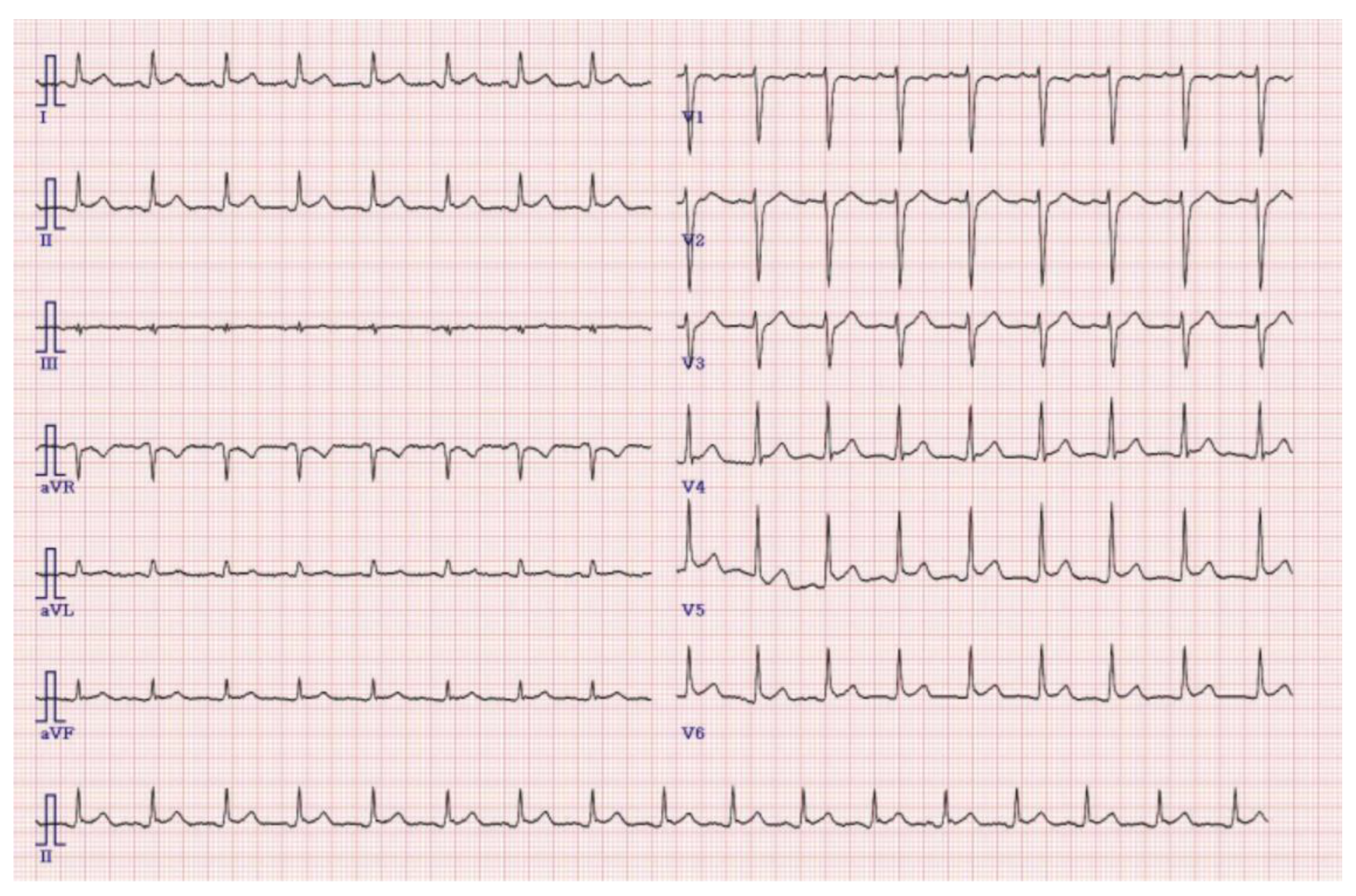 Children 09 01663 g002