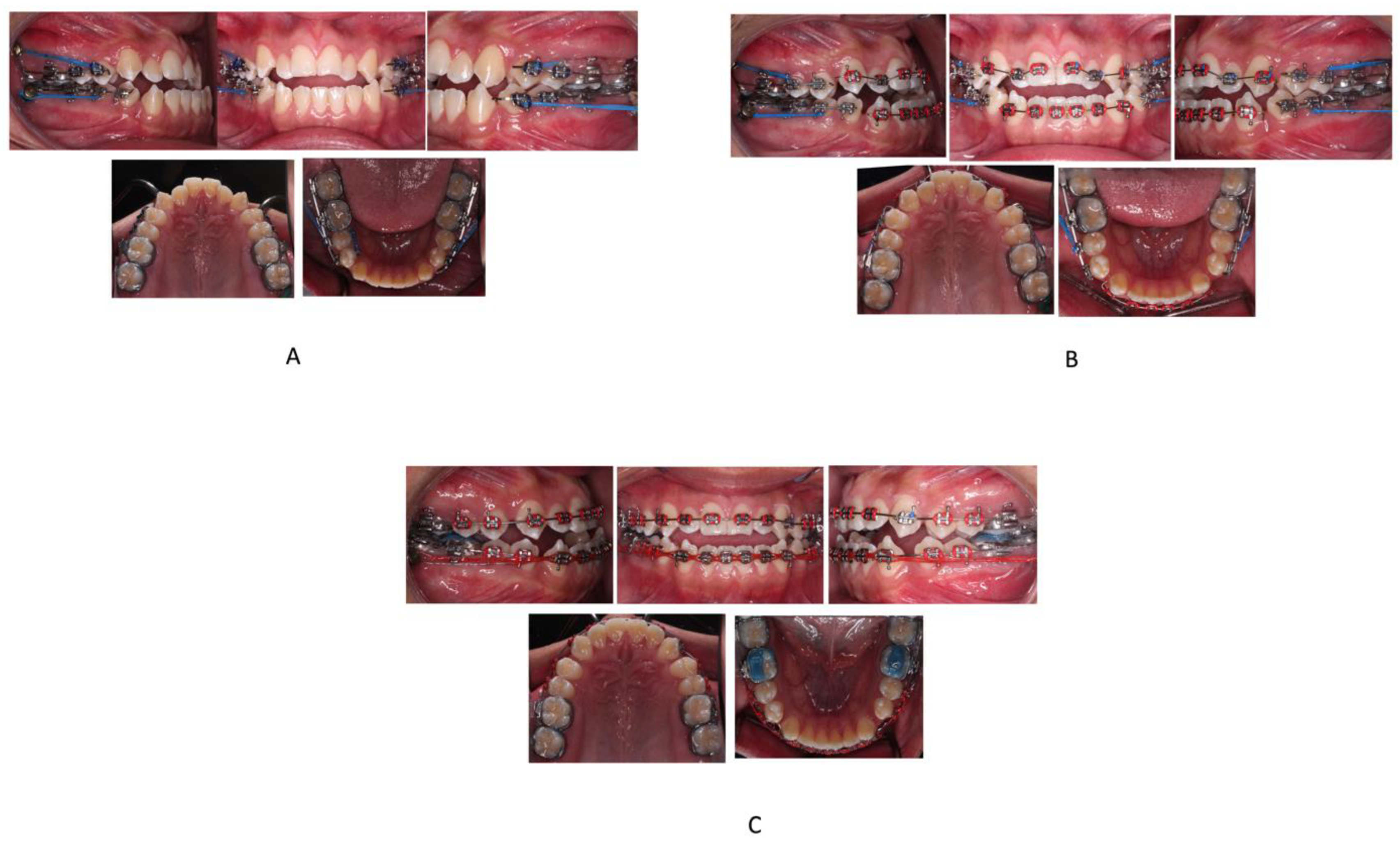 Children 09 01666 g002