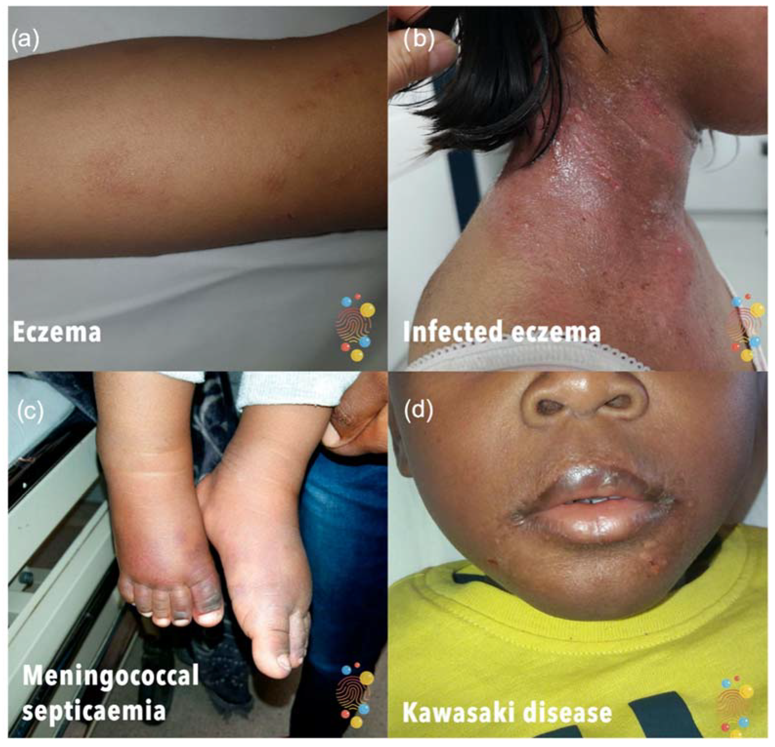 Children 09 01749 g001