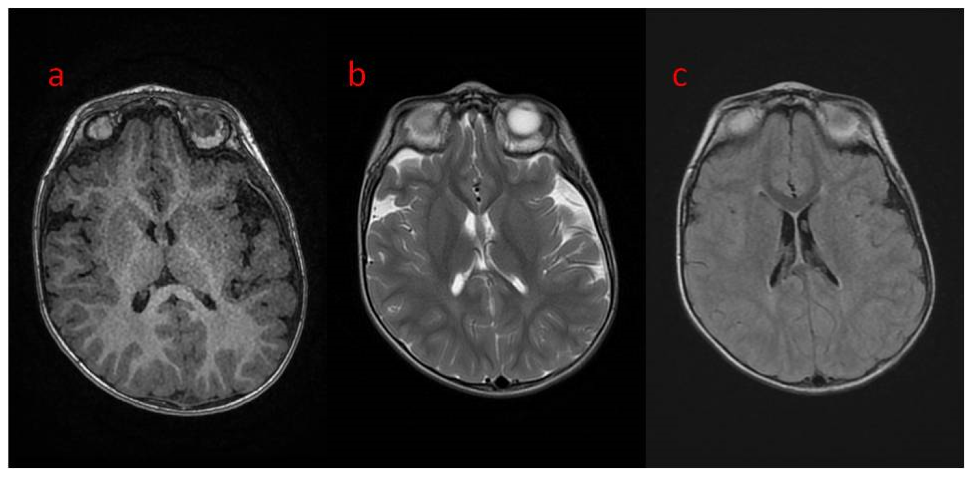 Children 09 01806 g001