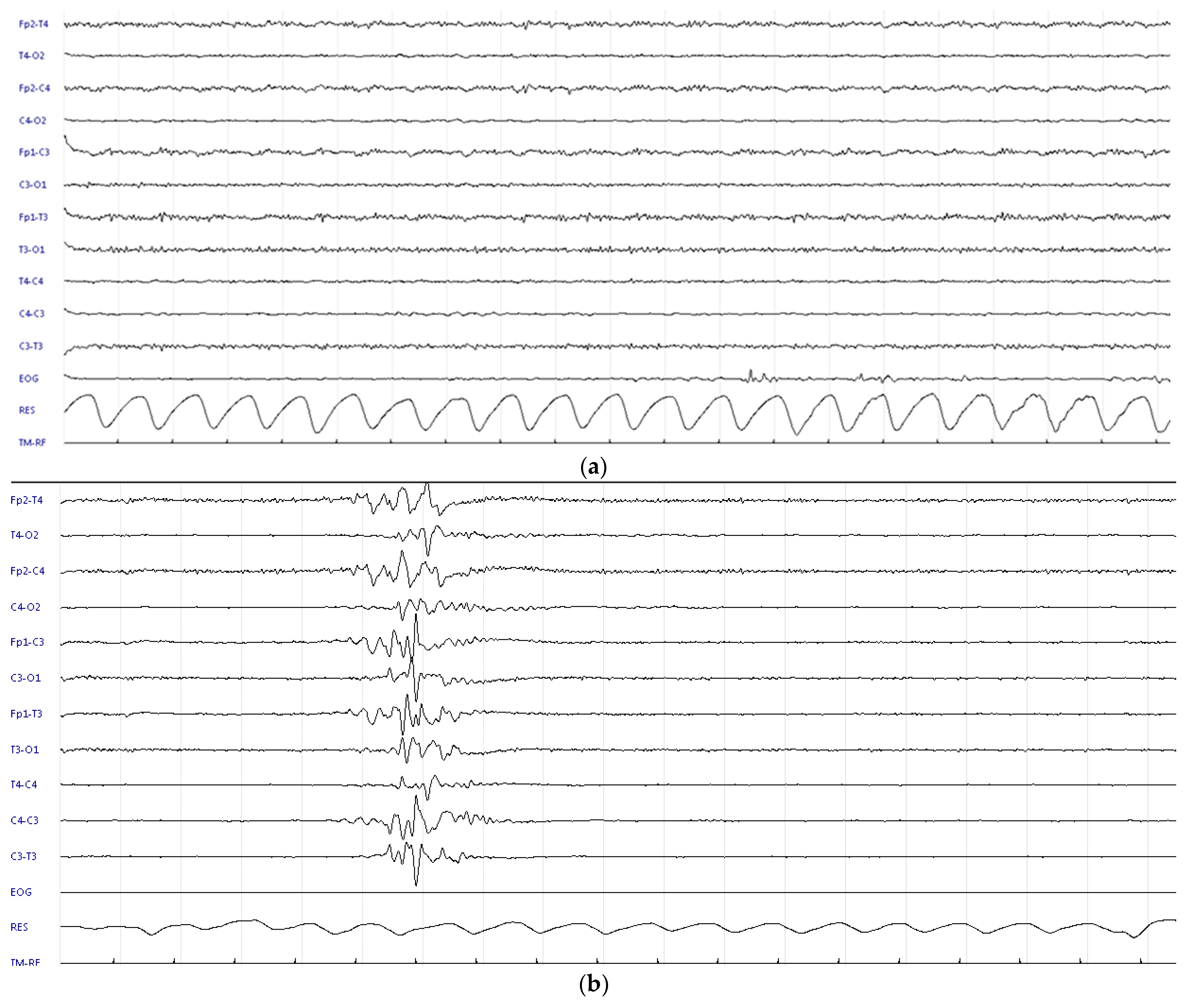 Children 09 01925 g001