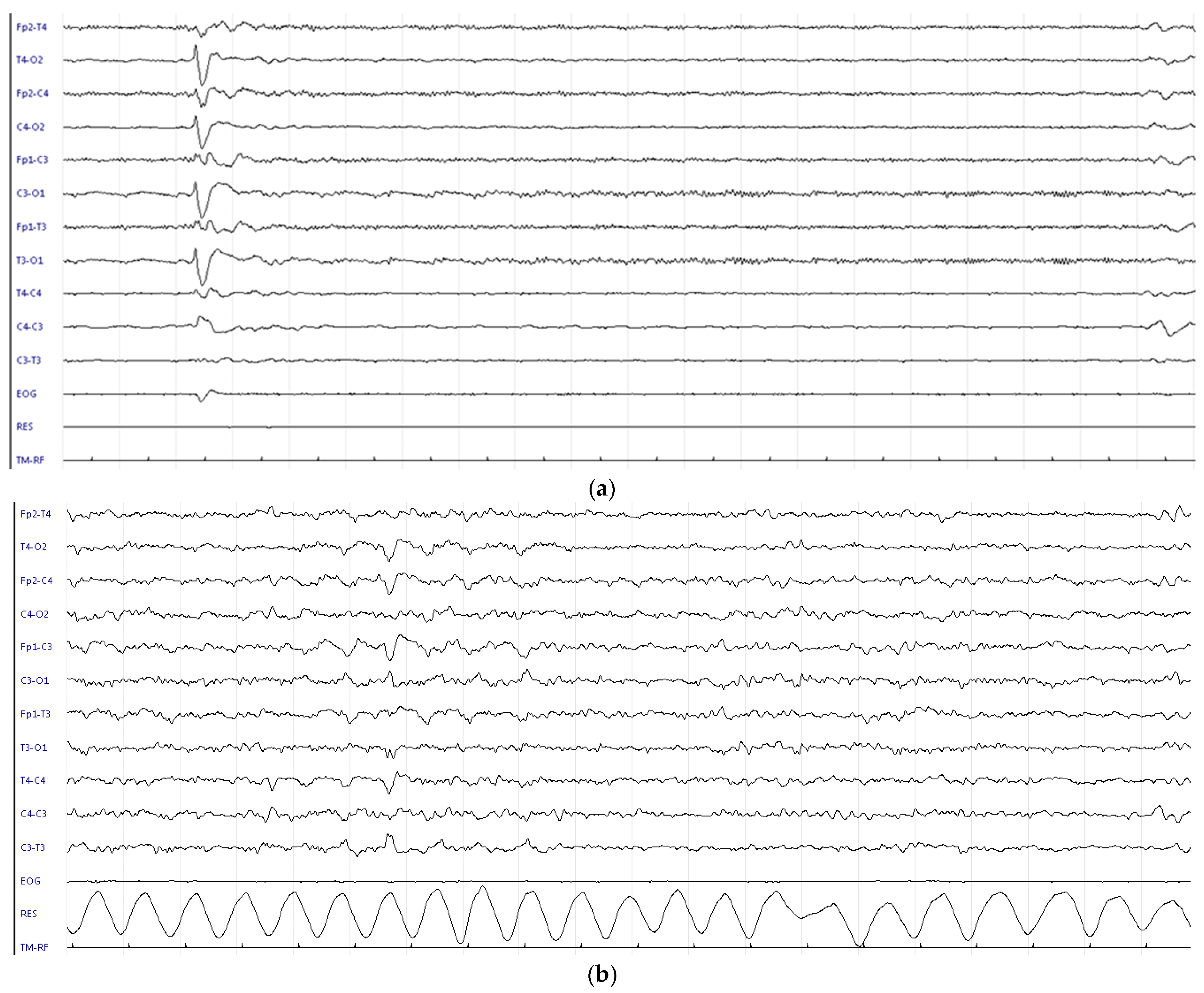 Children 09 01925 g002