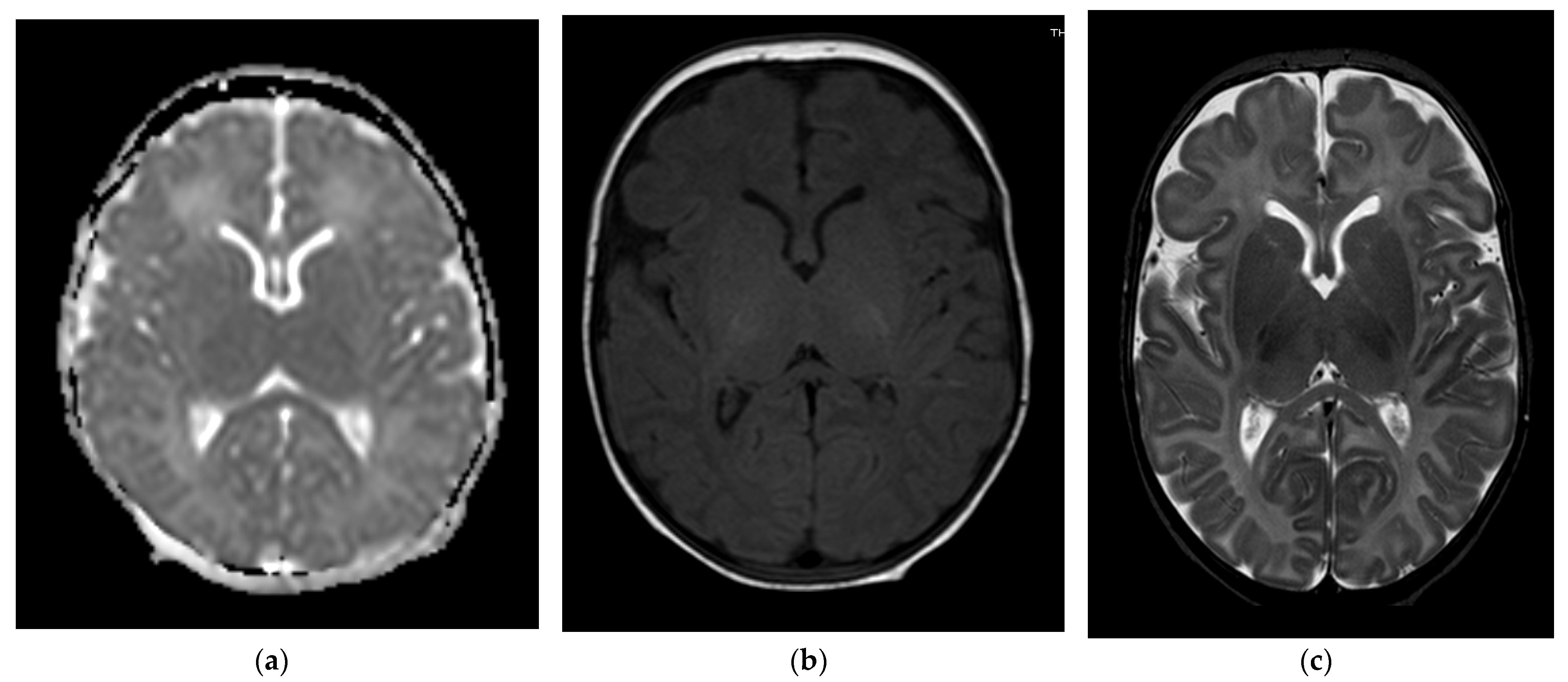 Children 09 01925 g003