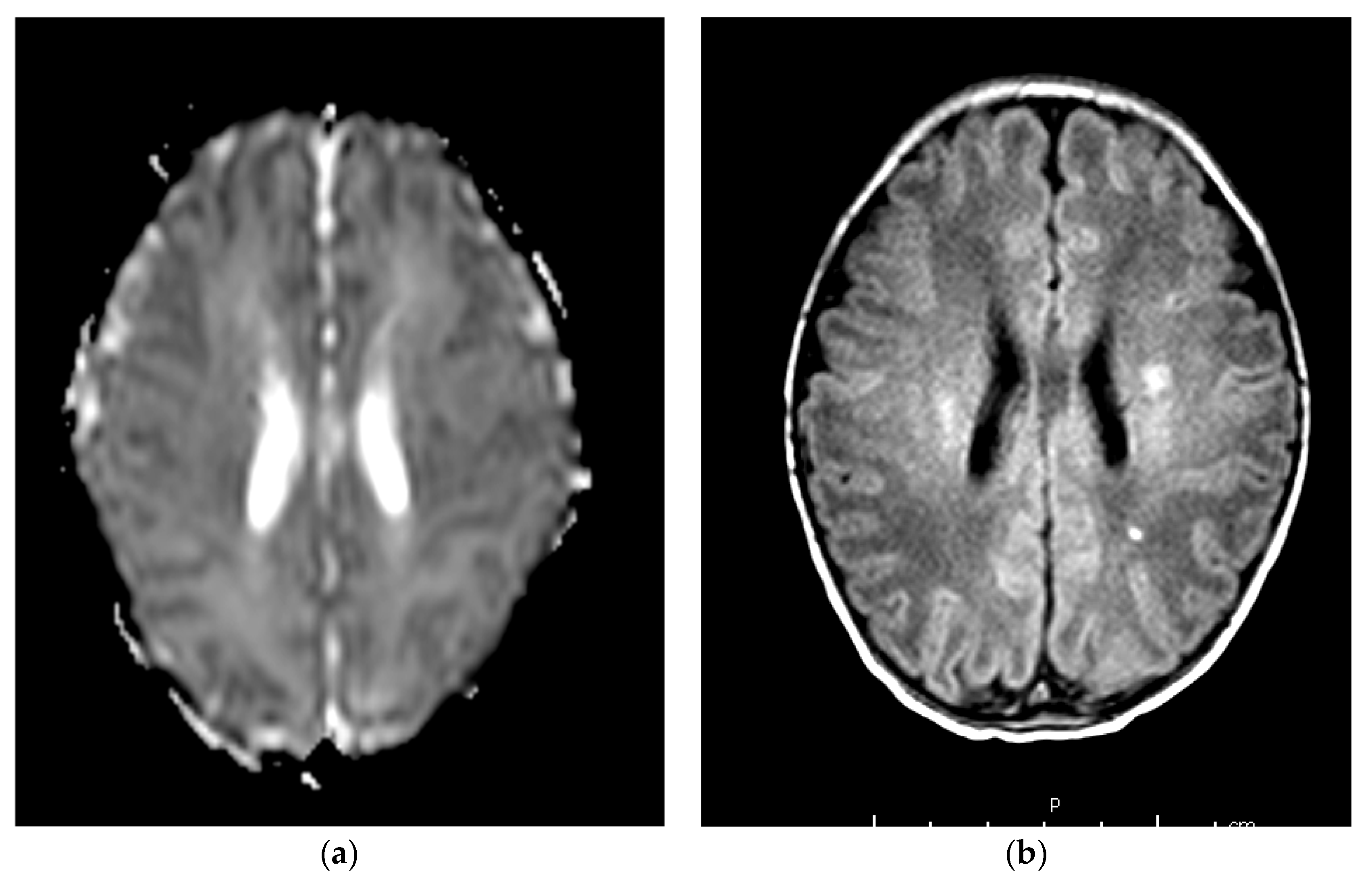 Children 09 01925 g004a