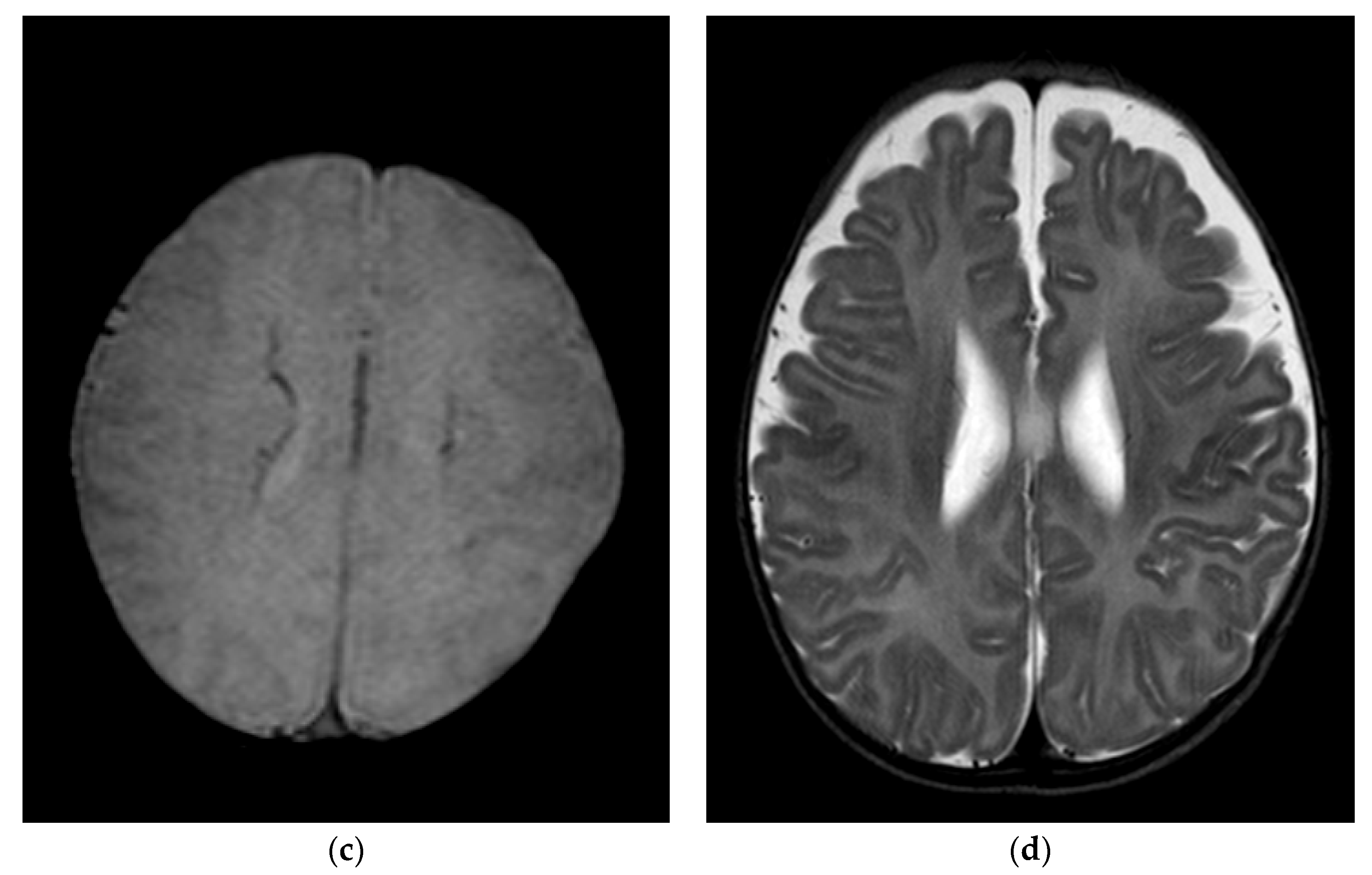 Children 09 01925 g004b