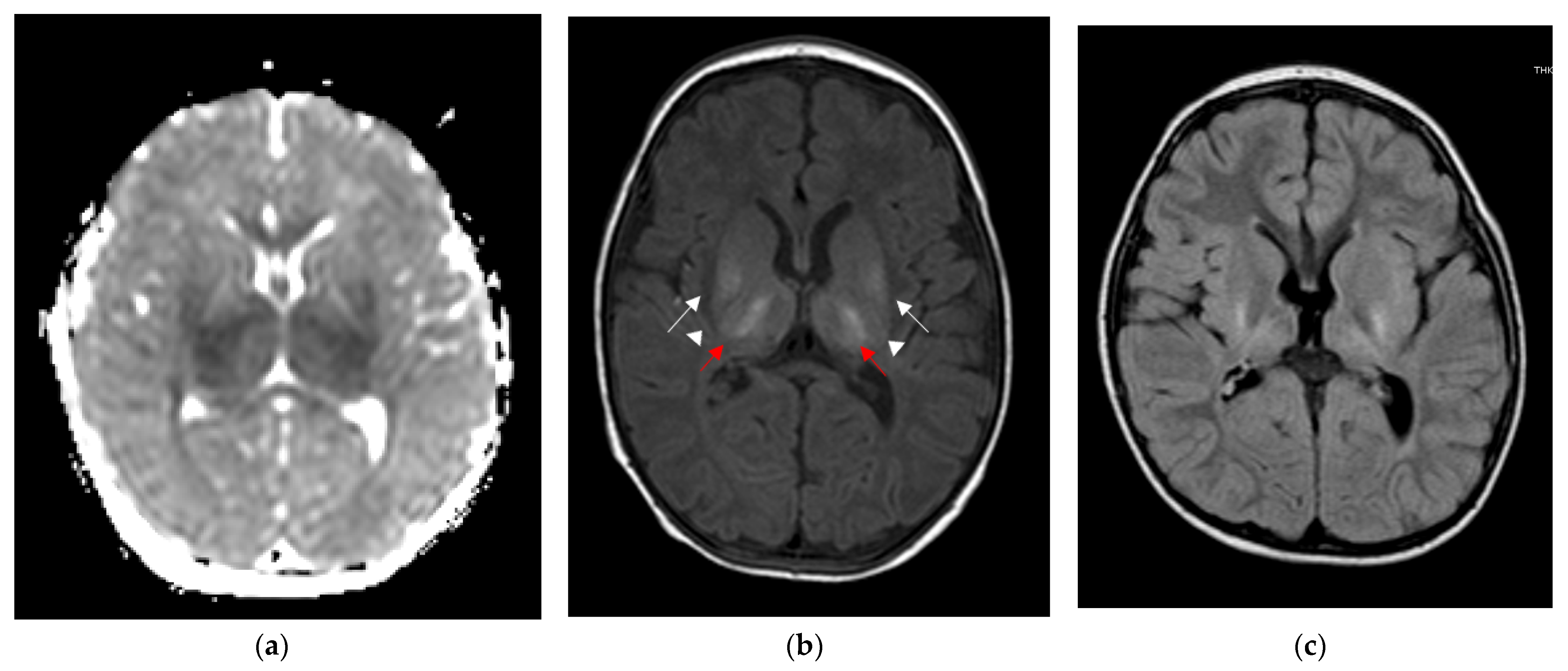 Children 09 01925 g005