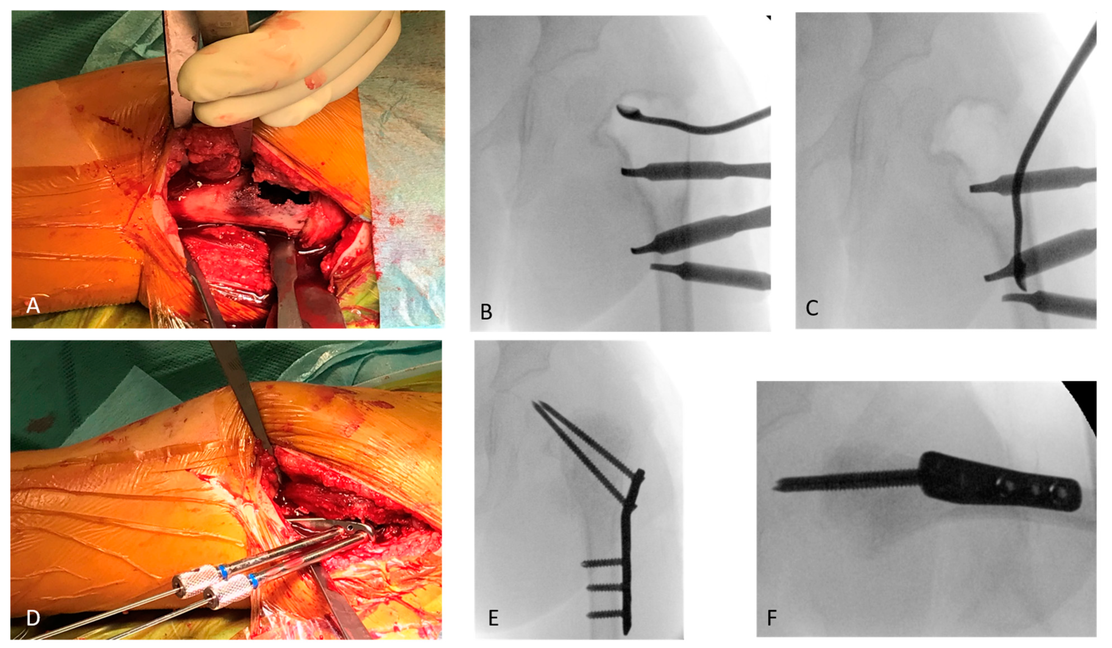 Children 09 01932 g002 Children 09 01932 g002