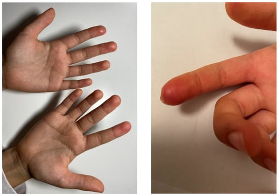 Children 09 01972 g0a1