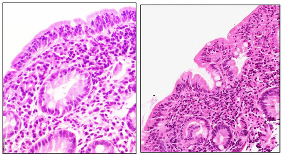 Children 09 01972 g0a3