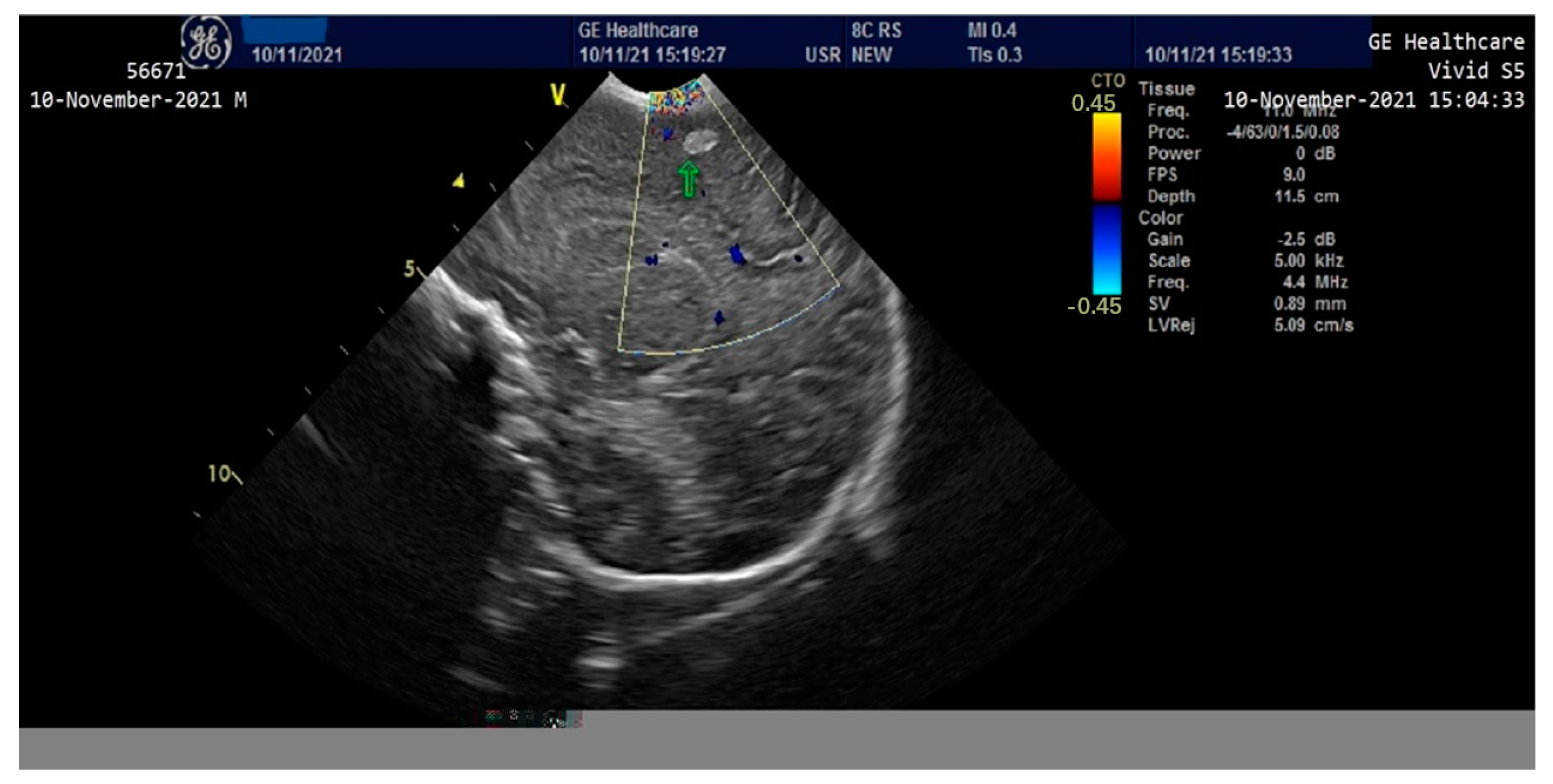 Children 10 00066 g003